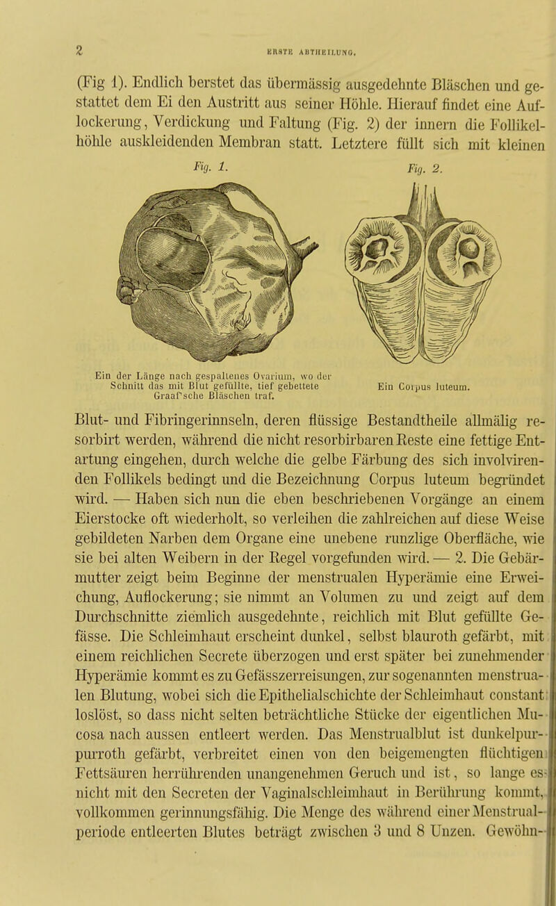 z (Fig 1). Endlich berstet das übermässig ausgedehnte Bläschen und ge- stattet dem Ei den Austritt aus seiner Höhle. Hierauf findet eine Auf- lockerung, Verdickung und Faltung (Fig. 2) der Innern die Follikel- höhle auskleidenden Membran statt. Letztere füllt sich mit kleinen Fig- 1- Fig. 2. Ein der Länge nach gespaltenes Ovaiium, wo clor Schnitt das mit Blut gefüllte, tief gebettete Ein Coijjus luteum. Graafsche Bläschen traf, Blut- und Fibringerinnseln, deren flüssige Bestandtheile allmälig re- sorbirt werden, während die nicht resorbirbaren Beste eine fettige Ent- artung eingehen, durch welche die gelbe Färbung des sich involviren- den Follikels bedingt und die Bezeichnung Corpus luteum begi-ündet wird. — Haben sich nun die eben beschriebenen Vorgänge an einem Eierstocke oft wiederholt, so verleihen die zahlreichen auf diese Weise gebildeten Narben dem Organe eine unebene runzlige Oberfläche, wie sie bei alten Weibern in der Regel vorgefunden wird. — 2. Die Gebär- mutter zeigt beim Beginne der menstrualen Hyperämie eine Erwei- chung, Auflockerung; sie nimmt an Volumen zu und zeigt auf dem Diu'chschnitte ziemlich ausgedehnte, reichlich mit Blut gefüllte Ge- fässe. Die Sclileimhaut erscheint dunkel, selbst blauroth gefärbt, mit einem reichlichen Secrete überzogen und erst später bei zunehmender Hyperämie kommt es zu Gefässzerreisungen, zur sogenannten menstrua- ■ len Blutung, wobei sich die Epithelialschichte der Sclileimhaut constant; loslöst, so dass nicht selten beträchtliche Stücke der eigentlichen Mu-- Cosa nach aussen entleert werden. Das Menstrualblut ist dunkelpur- purroth gefärbt, verbreitet einen von den beigemengten flüchtigem Fettsäuren herrührenden unangenehmen Geruch und ist, so lange es? nicht mit den Secreten der Vaginalsclileimhaut in Berülu-ung konnnt, vollkommen gerinnungsfähig. Die Menge des während einer jMenstrual Periode entleerten Blutes beträgt zwischen 3 und 8 Unzen. Gewöhn-