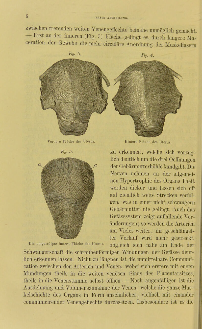 KnSTE ABTUEILUNG. zwischen tretenden weiten Venengeflechte beinahe unmöglich gemacht. — Erst an der inneren (Fig. 5) Fläche gelingt es, durch längere Ma- ceration der Gewebe die mein- circuläre Anordnung der Muskelfasern Vordere Fläche des Ulerus. Fig. 5. Hinlere Fläche des Uterus. ZU erkennen, welche sich vorzüg- lich deutlich um die drei Oefihungen der Gebärmutterhöhle kundgibt. Die Nerven nehmen an der allgemei- nen HyiJertrophie des Organs Theil, werden dicker und lassen sich oft auf ziemlich weite Strecken verfol- gen, was in einer nicht schwangern Gebärmutter nie gelingt. Auch das Gefässsystem zeigt auffallende Ver- änderungen; so werden die Arterien imi Vieles weiter, ihr geschlängel- ter Verlauf wird mehr gestreckt, obgleich sich nahe am Ende der Schwangerschaft die schraubenförmigen Windungen der Gefässe deut- lich erkennen lassen. Nicht zu läugnen ist die unmittelbare Conununi- cation zwischen den Arterien und Venen, wobei sich erstere mit engen Mündungen theils in die weiten venösen Sinus des Placentarsitzes, theils in die Venenstämme selbst öffiien. — Noch augenfälliger ist die Ausdehnung und Volumenszunahme der Venen, welche die ganze Mus- kelschichte des Organs in Form ansehnlicher, vielfach mit einander commimicirender Venengefleclite durchsetzen. Insbesondere ist es die Die umgestülpte innere Fläche des Uterus.