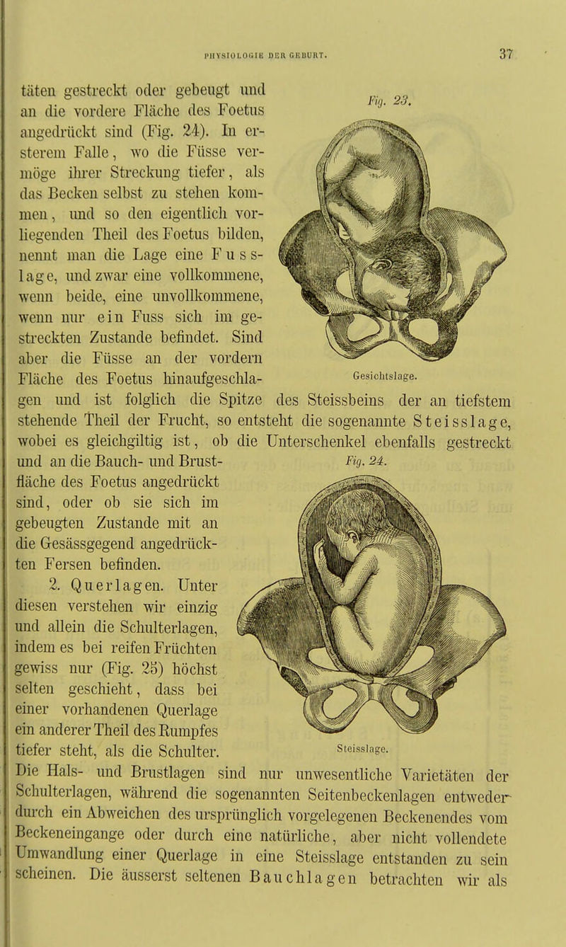 täten gestreckt oder eebeuftt und an die vordere Fläche des Foetiis augedrückt sind (Fig. 24). In er- sterem Falle, wo die Füsse ver- möge ihrer Streckung tiefer, als das Becken selbst zu stehen kom- men , und so den eigentlich vor- liegenden Theü desFoetus bilden, nennt man die Lage eine F u s s- lage, und zwar eine vollkommene, wenn beide, eine unvollkommene, wenn nur ein Fuss sich im ge- streckten Zustande befindet. Sind aber die Füsse an der vordem Fläche des Foetus hinaufgeschla- Fig. 23, Gesichtslage. gen und ist folglich die Spitze des Steissbeins der an tiefstem stehende Theil der Frucht, so entsteht die sogenannte Steisslage, wobei es gleichgiltig ist, ob die Unterschenkel ebenfalls gestreckt und an die Bauch- und Brust- fläche des Foetus angedrückt sind, oder ob sie sich im gebeugien Zustande mit an die Gesässgegend angedrück- ten Fersen befinden. 2. Querlagen, diesen verstehen wir und allein die Schulterlagen, indem es bei reifen Früchten gewiss nur (Fig. 25) höchst selten geschieht, dass bei einer vorhandenen Querlage ein anderer Theil desEumpfes tiefer steht, als die Schulter. Fig. 24. Unter emzig Steisslage. Die Hals- und Brustlagen sind nur unwesentliche Varietäten der Schulterlagen, während die sogenannten Seitenbeckenlagen entweder durch ein Abweichen des ursprünglich vorgelegenen Beckenendes vom Beckeneingange oder durch eine natürliche, aber nicht vollendete Umwandlung einer Querlage in eine Steisslage entstanden zu sein scheinen. Die äusserst seltenen Bauchlagen betrachten wir als