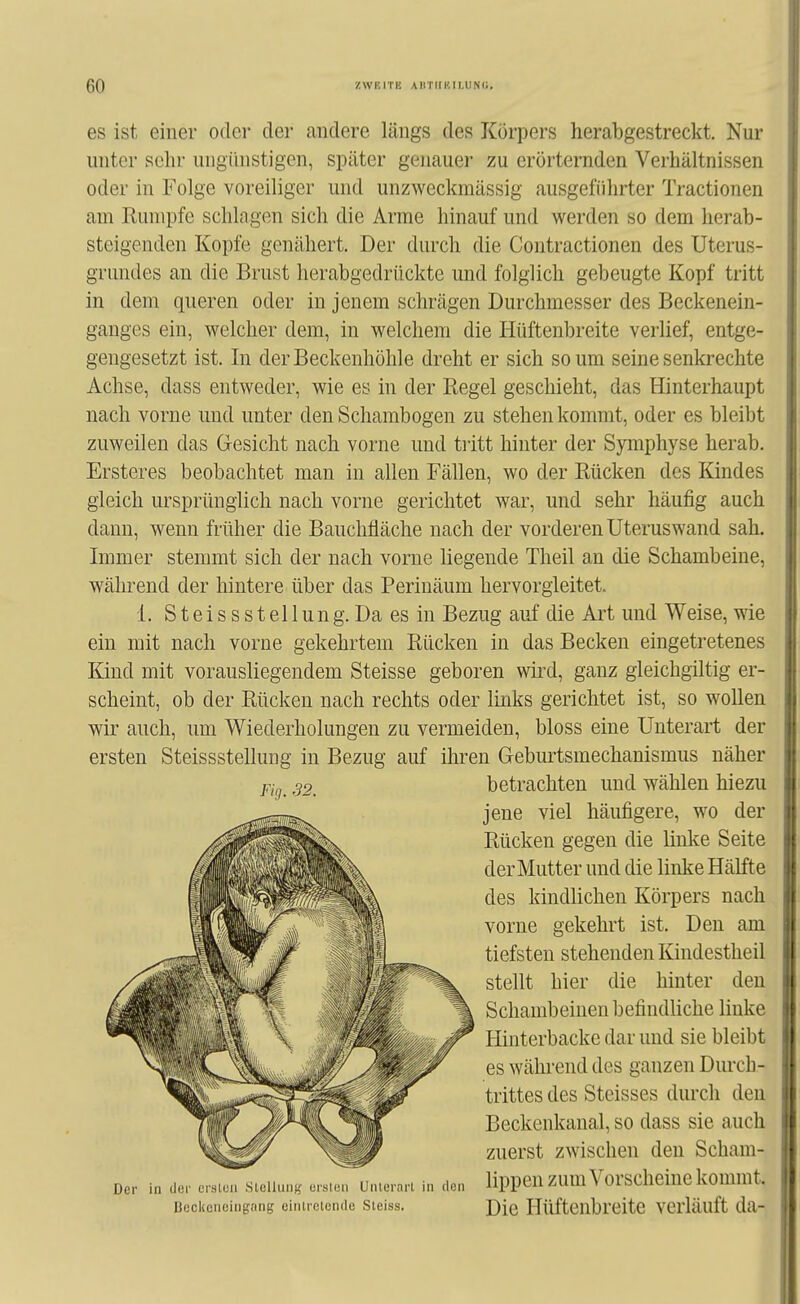 es ist einer oder der andere längs des Körpers herabgestreckt. Nur unter sehr ungihistigen, später genauer zu erörternden Verhältnissen oder in Folge voreiliger und unzweckraässig ausgeführter Tractionen am Rumpfe schlagen sich die Arme hinauf und werden so dem herab- steigenden Kopfe genähert. Der durch die Contractionen des Uterus- grundes an die Brust herabgedrückte und folglich gebeugte Kopf tritt in dem queren oder in jenem schrägen Durchmesser des Beckenein- ganges ein, welcher dem, in welchem die Hüftenbreite verlief, entge- gengesetzt ist. In der Beckenhöhle dreht er sich so um seine senkrechte Achse, dass entweder, wie es in der Regel geschieht, das Hinterhaupt nach vorne und unter den Schambogen zu stehen kommt, oder es bleibt zuweilen das Gesicht nach vorne und tiitt hinter der Symphyse herab. Ersteres beobachtet man in allen Fällen, wo der Rücken des Kindes gleich ursprünglich nach vorne gerichtet war, und sehr häufig auch dann, wenn früher die Bauchfläche nach der vorderen Uteruswand sah. Immer stemmt sich der nach vorne hegende Theil an die Schambeine, während der hintere über das Perinäum hervorgleitet. 1. S t e i s s s t e 11 u n g. Da es in Bezug auf die Art und Weise, wie ein mit nach vorne gekehrtem Rücken in das Becken eingetretenes Kind mit vorausliegendem Steisse geboren wkd, ganz gleichgiltig er- scheint, ob der Rücken nach rechts oder links gerichtet ist, so wollen wir auch, um Wiederholungen zu vermeiden, bloss eine Unterart der ersten Steissstellung in Bezug auf iln^en Gebm^tsmechanismus näher Der in der orsluii Slellung ersten Unterart in den Beckcneingnng eintretende Steiss. Fig. 32. betrachten und wählen hiezu jene viel häufigere, wo der Rücken gegen die linke Seite der Mutter und die linke Hälfte des kindlichen Körpers nach vorne gekehrt ist. Den am tiefsten stehenden Kindestheil stellt hier die hinter den Schambeinen befindhche linke Hinterbacke dar und sie bleibt es während des ganzen Durcb- trittes des Steisses durch den Beckenkanal, so dass sie auch zuerst zwischen den Scham- lippen zum Vorscheine kommt. Die Hüftenbreite verläuft da-