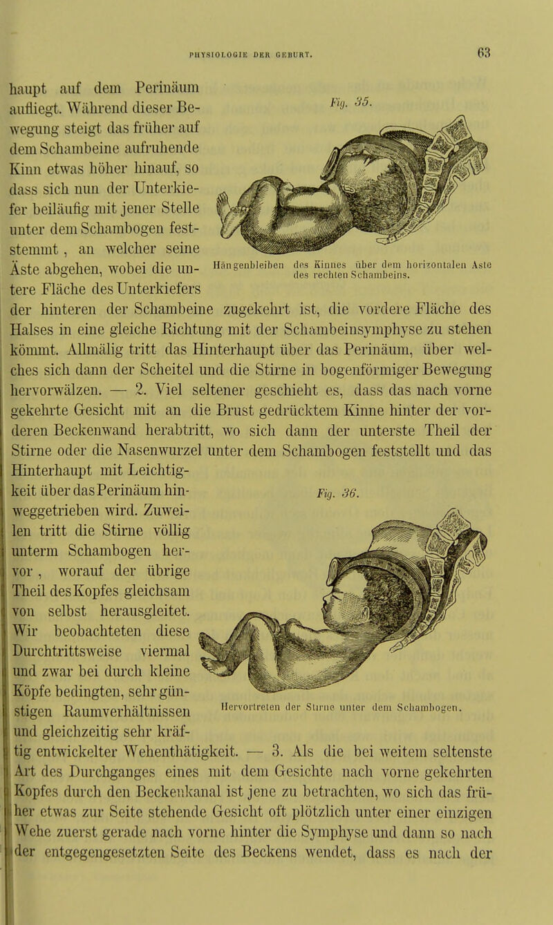 Fuj. 35. dfis Kinnes über dnin horizontalen Asle des rechten Schambeins. haupt auf dem Perinäum aufliegt. Wähi-end dieser Be- wegung steigt das früher auf dem Schambeine aufruhende Kinn etwas höher hinauf, so dass sich nun der Unterkie- fer beiläufig mit jener Stelle unter dem Schambogen fest- stemmt , an welcher seine Äste abgehen, wobei die un- Hängenbleiben tere Fläche des Unterkiefers der hinteren der Schambeine zugekehrt ist, die vordere Fläche des Halses in eine gleiche Richtung mit der Schambeinsymphyse zu stehen kömmt, Allmälig tritt das Hinterhaupt über das Perinäum, über wel- ches sich dann der Scheitel und die Stirne in bogenförmiger Bewegung hervorwälzen. — 2. Viel seltener geschieht es, dass das nach vorne gekehrte Gesicht mit an die Brust gedrücktem Kinne hinter der vor- deren Beckenwand herabtritt, wo sich danu der unterste Theil der Stirne oder die Nasenwurzel unter dem Schambogen feststellt und das Hinterhaupt mit Leichtig- keit über das Perinäum hin- pig. 36. weggetrieben wird. Zuwei- len tritt die Stirne völlig unterm Schambogen her- vor , worauf der übrige Theil des Kopfes gleichsam von selbst herausgleitet. Wir beobachteten diese Durchtrittsweise viermal und zwar bei diu'ch kleine Köpfe bedingten, sehr gün- stigen Raumverhältnissen und gleichzeitig sehr kräf- tig entwickelter Wehenthätigkeit. — 3. Als die bei weitem seltenste Ai-t des Durchganges eines mit dem Gesichte nach vorne gekehrten Kopfes durch den Beckeiikanal ist jene zu betrachten, wo sich das frü- her etwas zur Seite stehende Gesicht oft plötzlich unter einer einzigen Wehe zuerst gerade nach vorne hinter die Symphyse und dann so nach der entgegengesetzten Seite des Beckens wendet, dass es nach der Hervortreten der Stirno unter dem Schambogen.