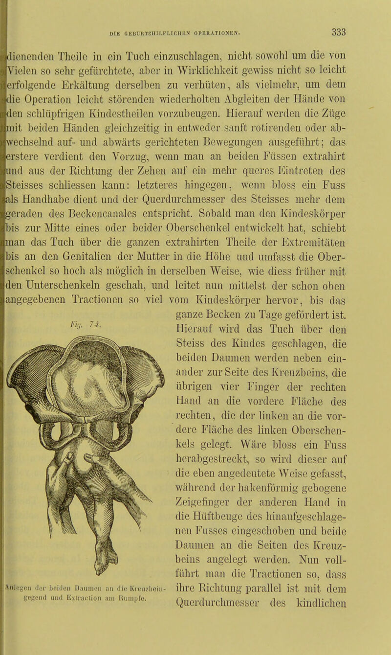 dienenden Theile in ein Tuch einzuschlagen, nicht sowohl um die von Vielen so sehr gefürchtete, aber in Wirklichkeit gewiss nicht so leicht erfolgende Erkältung derselben zu verhüten, als vielmehr, um dem die Operation leicht störenden wiederholten Abgleiten der Hände von den schlüpfrigen Kindestlieilen vorzubeugen. Hierauf werden die Züge mit beiden Händen gleichzeitig in entweder sanft rotirenden oder ab- wechselnd auf- und abwärts gerichteten Bewegungen ausgeführt; das erstere verdient den Vorzug, wenn man an beiden Füssen extrahirt und aus der Richtung der Zehen auf ein mehr queres Eintreten des Steisses schliessen kann: letzteres hingegen, wenn bloss ein Fuss als Handhabe dient und der Querdurchmesser des Steisses mehr dem geraden des Beckencanales entspricht. Sobald man den Kindeskörper bis zur Mitte eines oder beider Oberschenkel entwickelt hat, schiebt man das Tuch über die ganzen extrahirten Theile der Extremitäten bis an den Genitalien der Mutter in die Höhe und umfasst die Ober- schenkel so hoch als möglich in derselben Weise, wie diess früher mit den Unterschenkeln geschah, und leitet nun mittelst der schon oben langegebenen Tractionen so viel vom Kindeskörper hervor, bis das Ani(;-(!ii (i,;r ix'i.lun DiniiiKMi mi die Kiuuzhciii- Ihrc Richtung parallel ist mit dem Fiil. 74. ganze Becken zu Tage gefördert ist. Hierauf wird das Tuch über den Steiss des Kindes geschlagen, die beiden Daumen werden neben ein- ander zur Seite des Kreuzbeins, die übrigen vier Finger der rechten Hand an die vordere Fläche des rechten, die der linken an die vor- dere Fläche des linken Oberschen- kels gelegt. Wäre bloss ein Fuss herabgestreckt, so wird dieser auf die eben angedeutete Weise gefasst, während der hakenförmig gebogene Zeigefinger der anderen Hand in die Hüftbeuge des hinaufg(!schlage- nen Fusses eingeschoben und beide Daumen au die Seiten des Kreuz- beins angelegt werden. Nun voll- führt man die Tractionen so, dass Querdurchmesser des kindlichen