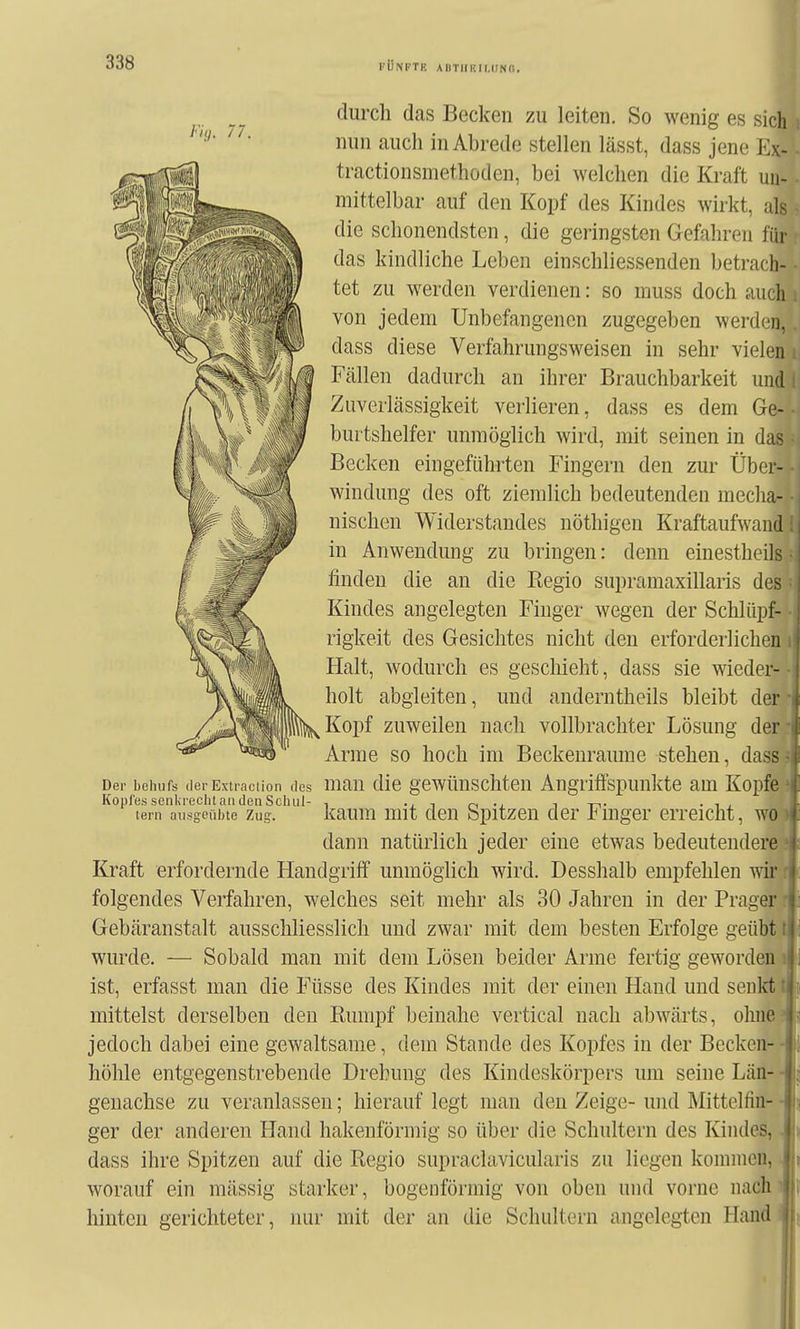 FÜNFTP. ABTlIUII.IINd. /•/(;. //. durch das Becken zu leiten. So wenig es sich nun auch in Abrede stellen lässt, dass jene Ex- tractionsmethoden, bei welchen die Kraft un- mittelbar auf den Kopf des Kindes wirkt, als die schonendsten, die geringsten Gefahren für das kindliche Leben einschliessenden betrach- tet zu werden verdienen: so muss doch auch von jedem Unbefangenen zugegeben werdc^n, dass diese Verfahrungsweisen in sehr vielen Fällen dadurch an ihrer Brauchbarkeit und Zuverlässigkeit verlieren, dass es dem Ge- burtshelfer unmöglich wird, mit seinen in das Becken eingeführten Fingern den zur Über- windung des oft ziemlich bedeutenden mecha- nischen Widerstandes nöthigen Kraftaufwand in Anwendung zu bringen: denn einestheils finden die an die Regio supramaxillaris des Kindes angelegten Finger wegen der Schlüpf- rigkeit des Gesichtes nicht den erforderlichen Halt, wodurch es geschieht, dass sie wieder- holt abgleiten, und anderntheils bleibt der Kopf zuweilen nach vollbrachter Lösung der Arme so hoch im Beckeuraume stehen, dass ■ Der behufs derExtiaciion des uiau die gcwünschteu Angriffspunkte am Kopfe KopfessenlirecluaiulenSchul- , i o -j i -rr • i , lern ausgeübte Zug. kaum mit dcu Spitzcn der Jbmger erreicht, wo dann natürlich jeder eine etwas bedeutendere Kraft erfordernde Handgriff unmöglich wird. Desshalb empfehlen wir folgendes Verfahren, welches seit mehr als 30 Jahren in der Prager Gebäranstalt ausschliesslich und zwar mit dem besten Erfolge geübt 11 wurde. — Sobald man mit dem Lösen beider Arme fertig geworden 1 ist, erfasst man die Füsse des Kindes mit der einen Hand und senkt '\ mittelst derselben den Rumpf beinahe vertical nach abwärts, ohne jedoch dabei eine gewaltsame, dem Stande des Kopfes in der Becken- höhle entgegenstrebende Drehung des Kindeskörpers um seine Län- geuachse zu veranlassen; hierauf legt man den Zeige- und Mittelfin- ger der anderen Hand hakenförmig so über die Schultern des Kindes, dass ihre Spitzen auf die Regio supraclavicularis zu liegen kommen, worauf ein mässig starker, bogenförmig von oben und vorne nach hinten gerichteter, nur mit der an die Schultern angelegten Handi