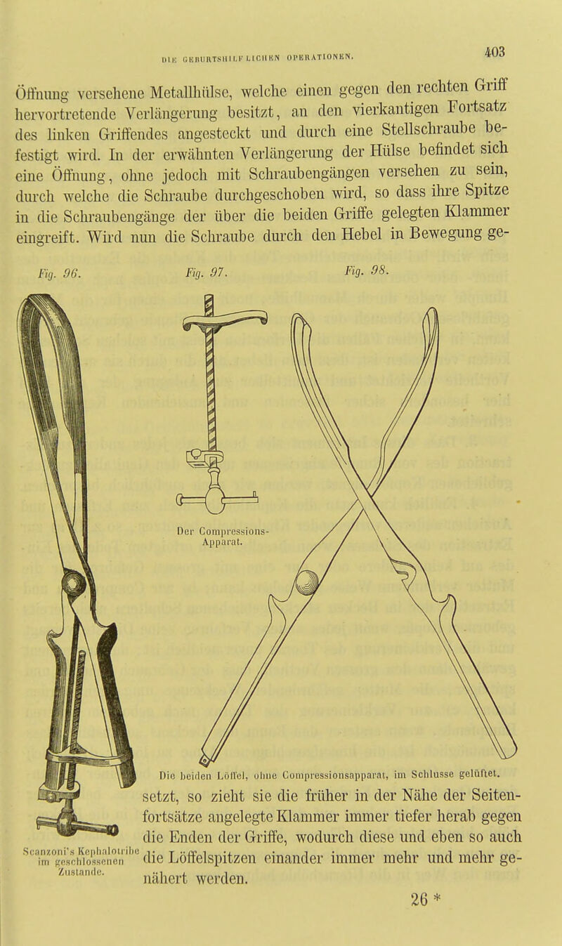 IHK ClällllllTSIIII.r Lir.lM'.N Ol'EllATlONEN. Öffnuug versehene Metallhiilse, welche einen gegen den rechten Griff hervortretende Verlängerung besitzt, an den vierkantigen Fortsatz des linken Griffendes angesteckt und durch eine Stellschraube be- festigt wird. In der erwähnten Verlängerung der Hülse befindet sich eine Öffnung, ohne jedoch mit Schraubengängen versehen zu sein, durch welche die Schraube durchgeschoben wird, so dass ihre Spitze in die Schraubengänge der über die beiden Griffe gelegten Klammer eingreift. Wird nun die Schraube durch den Hebel in Bewegung ge- Fig. 96. Fig. 97. Fig. 98. Die beiden LöfVel, oliiie Compressionsapparat, im Schlüsse gelüftet. setzt, so zieht sie die früher in der Nähe der Seiten- fortsätze angelegte Klammer immer tiefer herab gegen die Enden der Griffe, wodurch diese und eben so auch ,scanzoni'sKcpi„-.iot,ihe^^.g Löffelspitzen einander immer mehr und mehr ge- im Beschlossenen Zustande. nähert werden. 26*