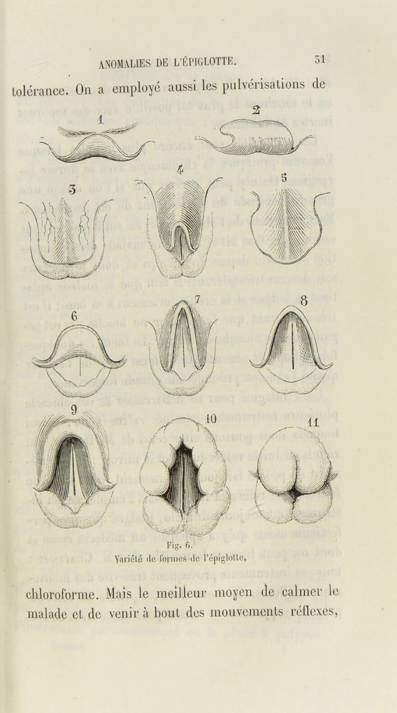 Fig. 0. Yaricté tic l’oriucs de l’épigloUe, chloroforme. Mais le meilleui’ moyen de calmer le malade eL de venir à bout des mouvemenls réllexes,