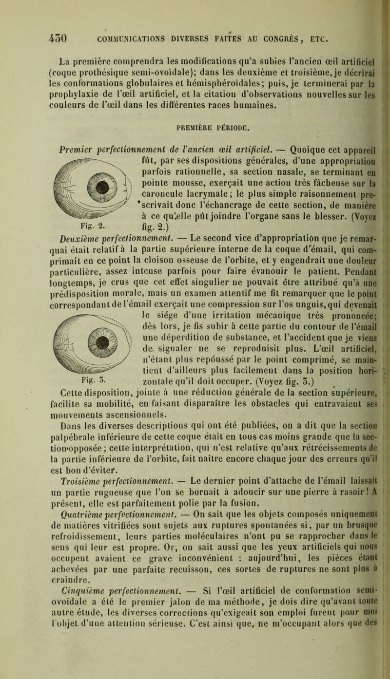 La première comprendra les modifications qu’a subies l’ancien œil artificiel (coque prothésique semi-ovoïdale); dans les deuxième et troisième, je décrirai les conformations globulaires et hémisphéroïdales; puis, je terminerai par la prophylaxie de l’œil artificiel, et la citation d’observations nouvelles sur les couleurs de l’œil dans les différentes races humaines. PREMIÈRE PÉRIODE. Fig. 2. Fig. 3. Premier perfectionnement de l'ancien œil artificiel. — Quoique cet appareil fût, par ses dispositions générales, d’une appropriation parfois rationnelle, sa section nasale, se terminant en pointe mousse, exerçait une action très fâcheuse sur la caroncule lacrymale; le plus simple raisonnement pre- scrivait donc l’échancrage de cette section, de manière à ce qu’.elle pût joindre l’organe sans le blesser. (Voyez fi* a.) Deuxième perfectionnement. — Le second vice d’appropriation que je remar- quai était relatif à la partie supérieure interne de la coque d’émail, qui com- primait en ce point la cloison osseuse de l’orbite, et y engendrait une douleur particulière, assez intense parfois pour faire évanouir le patient. Pendant longtemps, je crus que cet effet singulier ne pouvait être attribué qu’à une prédisposition morale, mais un examen attentif me fit remarquer que le point correspondant de l’émail exerçait une compression sur l’os unguis, qui devenait le siège d’une irritation mécanique très prononcée; dès lors, je fis subir à cette partie du contour de l’émail une déperdition de substance, et l’accident que je viens de signaler ne se reproduisit plus. L’œil artificiel, n’étant plus repoussé par le point comprimé, se main- tient d’ailleurs plus facilement dans la position hori- zontale qu’il doit occuper. (Voyez fig. 3.) Cette disposition, jointe à une réduction générale de la section supérieure, facilite sa mobilité, en faisant disparaître les obstacles qui entravaient ses mouvements ascensionnels. Dans les diverses descriptions qui ont été publiées, on a dit que la section palpébrale inférieure de cette coque était en tous cas moins grande que la sec- tiomopposée ; celte interprétation, qui n’est relative qu’aux rétrécissements de la partie inférieure de l’orbite, fait naître encore chaque jour des erreurs qu’il est bon d’éviter. Troisième perfectionnement. — Le dernier point d’attache de l’émail laissait un partie rugueuse que l’on se bornait à adoucir sur une pierre à rasoir! A présent, elle est parfaitement polie par la fusion. Quatrième perfectionnement. — On sait que les objets composés uniquement de matières vitrifiées sont sujets aux ruptures spontanées si, par un brusque refroidissement, leurs parties moléculaires n’ont pu se rapprocher dans le sens qui leur est propre. Or, on sait aussi que les yeux artificiels qui nous occupent avaient ce grave inconvénient : aujourd’hui, les pièces étant achevées par une parfaite recuisson, ces sortes de ruptures ne sont plus à craindre. Cinquième perfectionnement. — Si l’œil artificiel de conformation semi- ovoïdale a été le premier jalon de ma méthode, je dois dire qu’avant toute autre étude, les diverses corrections qu’exigeait son emploi furent pour moi l'objet d’une attention sérieuse. C’est ainsi que, ne m’occupant alors que des