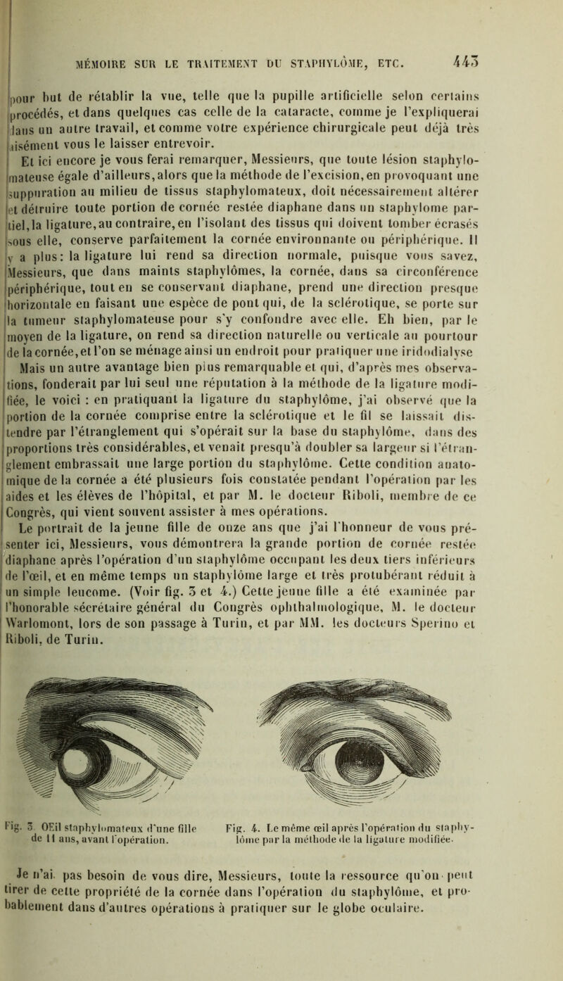pour but de rétablir la vue, telle que la pupille artificielle selon certains procédés, et dans quelques cas celle de la cataracte, comme je l’expliquerai jaus un autre travail, et comme votre expérience chirurgicale peut déjà très aisément vous le laisser entrevoir. El ici encore je vous ferai remarquer, Messieurs, que toute lésion staphylo- mateuse égale d’ailleurs,alors que la méthode de l’excision, en provoquant une suppuration au milieu de tissus slaphylomaleux, doit nécessairement altérer et détruire toute portion de cornée restée diaphane dans un staphylome par- ticipa ligature,au contraire,en l’isolant des tissus qui doivent tomber écrasés sous elle, conserve parfaitement la cornée environnante ou périphérique. Il v a plus: la ligature lui rend sa direction normale, puisque vous savez. Messieurs, que dans maints staphylômes, la cornée, dans sa circonférence périphérique, tout en se conservant diaphane, prend une direction presque horizontale en faisant une espèce de pont qui, de la sclérotique, se porte sur la tumeur staphylomateuse pour s'y confondre avec elle. Eh bien, par le moyen de la ligature, on rend sa direction naturelle ou verticale au pourtour de la cornée,et l’on se ménage ainsi un endroit pour pratiquer une iridodialyse Mais un autre avantage bien pius remarquable et qui, d’après mes observa- tions, fonderait par lui seul une réputation à la méthode de la ligature modi- fiée, le voici : en pratiquant la ligature du staphylome, j’ai observé que la portion de la cornée comprise entre la sclérotique et le fil se laissait dis- tendre par l’étranglement qui s’opérait sur la base du staphylome, dans des proportions très considérables, et venait presqu’à doubler sa largeur si l’étran- glement embrassait une large portion du staphylome. Cette condition anato- mique de la cornée a été plusieurs fois constatée pendant l’opération par les aides et les élèves de l’hôpital, et par M. le docteur Riboli, membre de ce Congrès, qui vient souvent assister à mes opérations. Le portrait de la jeune fille de onze ans que j’ai l'honneur de vous pré- I senter ici, Messieurs, vous démontrera la grande portion de cornée restée diaphane après l’opération d’un staphylome occupant les deux tiers inférieurs de l’œil, et en même temps un staphylome large et très protubérant réduit à un simple leucome. (Voir fig. 3 et 4.) Cette jeune fille a été examinée par l’honorable sécrétaire général du Congrès ophthalrnologique, M. le docteur I Warlomont, lors de son passage à Turin, et par MM. les docteurs Sperino et ! Kiboli, de Turin. Fig- 3 OEil staphylomafeux d'une fille Fig. 4. Le même œil après 1’opérntion du siaphy- de 11 ans, avant l'opération. îôme par la méthode de la ligature modifiée. Je n’ai, pas besoin de vous dire, Messieurs, toute la ressource qu’on peut tirer de cette propriété de la cornée dans l’opération du staphylome, et pro- bablement dans d’autres opérations à pratiquer sur le globe oculaire.