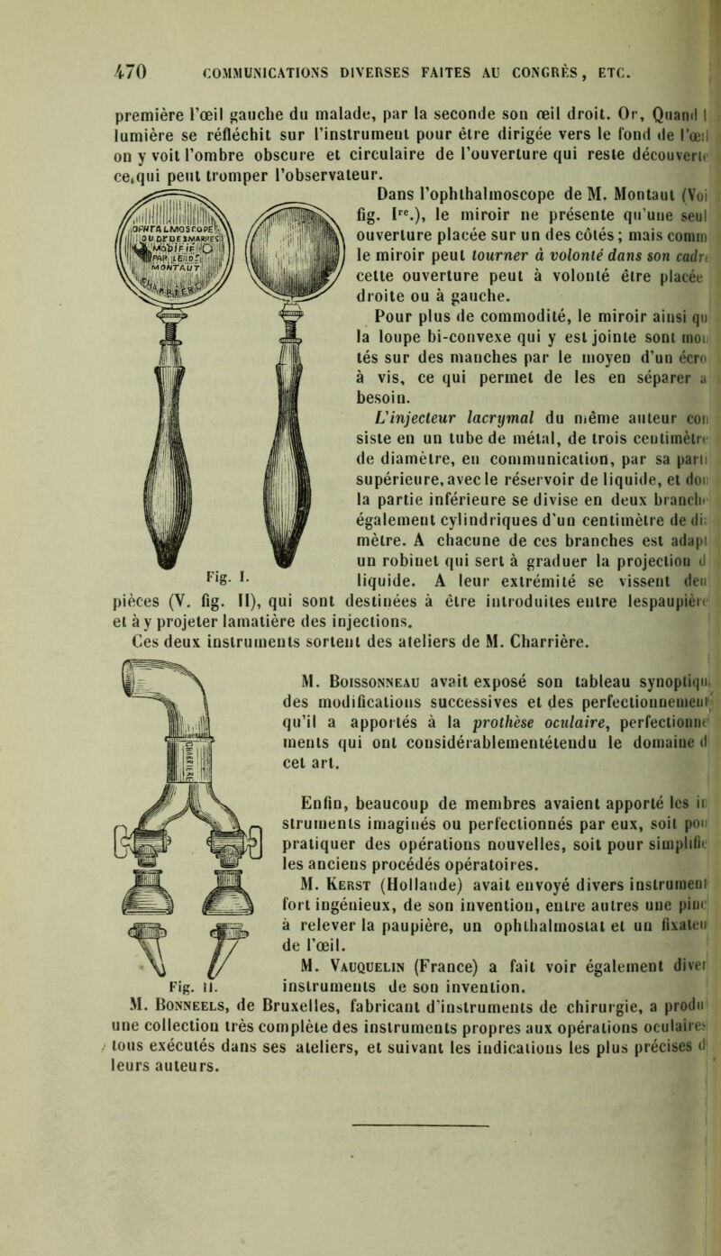 première l’œil gauche du malade, par la seconde son œil droit. Or, Quand I lumière se réfléchit sur l’instrument pour être dirigée vers le fond de l’œil on y voit l’ombre obscure et circulaire de l’ouverture qui reste découverte ce,qui peut tromper l’observateur. Dans l’ophthalmoscope de M. Montaut (Voi fig. Ire.), le miroir ne présente qu’une seul ouverture placée sur un des côtés ; mais comm le miroir peut tourner à volonté dans son cadrt cette ouverture peut à volonté être placée droite ou à gauche. Pour plus de commodité, le miroir ainsi qu la loupe bi-convexe qui y est jointe sont moi tés sur des manches par le moyen d’un écro à vis, ce qui permet de les en séparer a besoin. L'injecteur lacrymal du même auteur cou siste en un tube de métal, de trois centimètr» de diamètre, en communication, par sa pain supérieure, avec le réservoir de liquide, et don la partie inférieure se divise en deux branclu également cylindriques d'un centimètre de di mètre. A chacune de ces branches est adapi un robinet qui sert à graduer la projecliou d FiS- 1* liquide. A leur extrémité se vissent den pièces (V. fig. Il), qui sont destinées à être introduites entre lespaupièn et à y projeter lamatière des injections. Ces deux instruments sortent des ateliers de M. Charrière. M. Boissonneau avait exposé son tableau synopliqu. des modifications successives et des perfectionnement qu’il a apportés à la prothèse oculaire, perfectionne merits qui ont considérablementétendu le domaine d cet art. Enfin, beaucoup de membres avaient apporté les in struments imaginés ou perfectionnés par eux, soit pou pratiquer des opérations nouvelles, soit pour simplifie les anciens procédés opératoires. M. Kerst (Hollande) avait envoyé divers instrument fort ingénieux, de son invention, entre autres une pim à relever la paupière, un ophthalmostat et un fixaten de l’œil. M. Vauquelin (France) a fait voir également diver instruments de son invention. M. Bonneels, de Bruxelles, fabricant d'instruments de chirurgie, a prodo une collection très complète des instruments propres aux opérations oculaire* tous exécutés dans ses ateliers, et suivant les indications les plus précises d leurs auteurs.