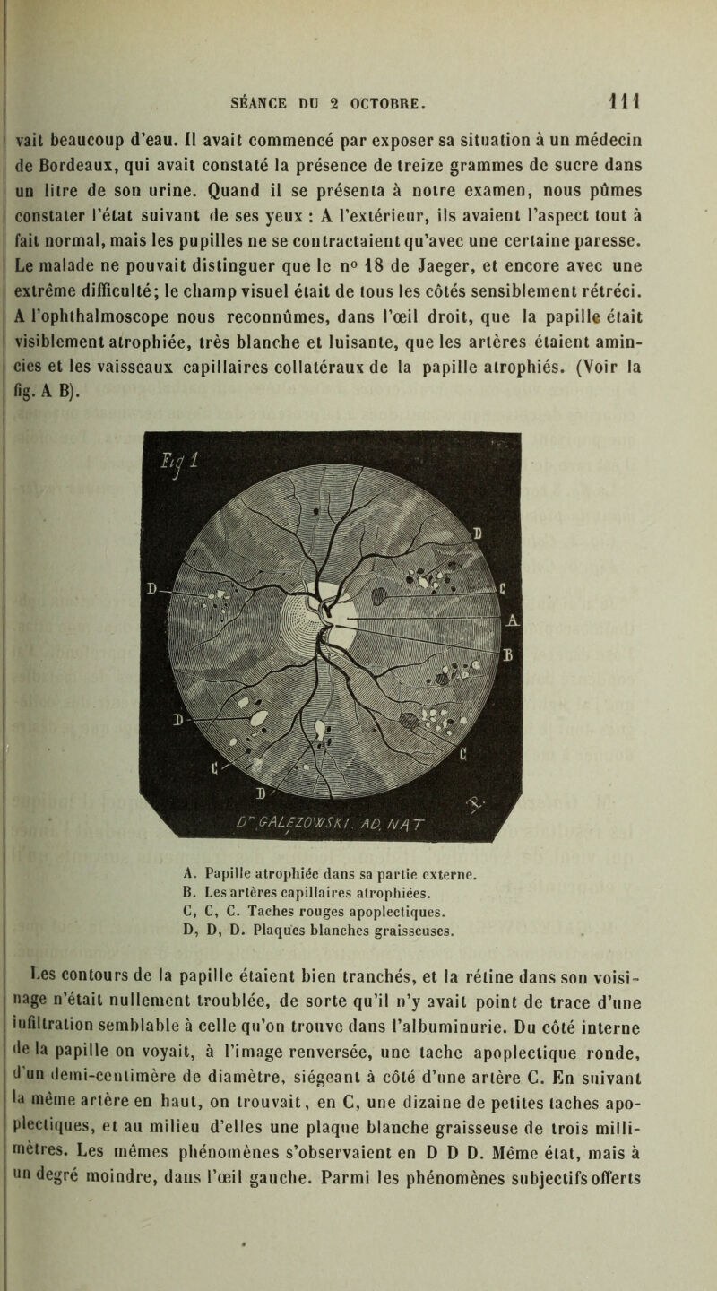 ! vait beaucoup d’eau. II avait commencé par exposer sa situation à un médecin j de Bordeaux, qui avait constaté la présence de treize grammes de sucre dans un litre de son urine. Quand il se présenta à noire examen, nous pûmes constater l’état suivant de ses yeux : A l’extérieur, ils avaient l’aspect tout à fait normal, mais les pupilles ne se contractaient qu’avec une certaine paresse. Le malade ne pouvait distinguer que le n» 18 de Jaeger, et encore avec une I extrême difficulté; le champ visuel était de tous les côtés sensiblement rétréci. : A l’ophthalmoscope nous reconnûmes, dans l’œil droit, que la papille était I visiblement atrophiée, très blanche et luisante, que les artères étaient amin- cies et les vaisseaux capillaires collatéraux de la papille atrophiés. (Voir la fig. A B). A. Papille atrophiée dans sa partie externe. B. Les artères capillaires atrophiées. C. C, C. Taches rouges apoplectiques. j D, D, D. Plaques blanches graisseuses. ! Les contours de la papille étaient bien tranchés, et la rétine dans son voisi- I nage n’était nullement troublée, de sorte qu’il n’y avait point de trace d’une 1 infiltration semblable à celle qu’on trouve dans l’albuminurie. Du côté interne i <le la papille on voyait, à l’image renversée, une tache apoplectique ronde, I d’un (leini-ceniimère de diamètre, siégeant à côté d’une artère C. En suivant I la même artère en haut, on trouvait, en C, une dizaine de petites taches apo- I plectiques, et au milieu d’elles une plaque blanche graisseuse de trois milli- mètres. Les mêmes phénomènes s’observaient en D D D. Même état, mais à un degré moindre, dans l’œil gauche. Parmi les phénomènes subjectifs offerts