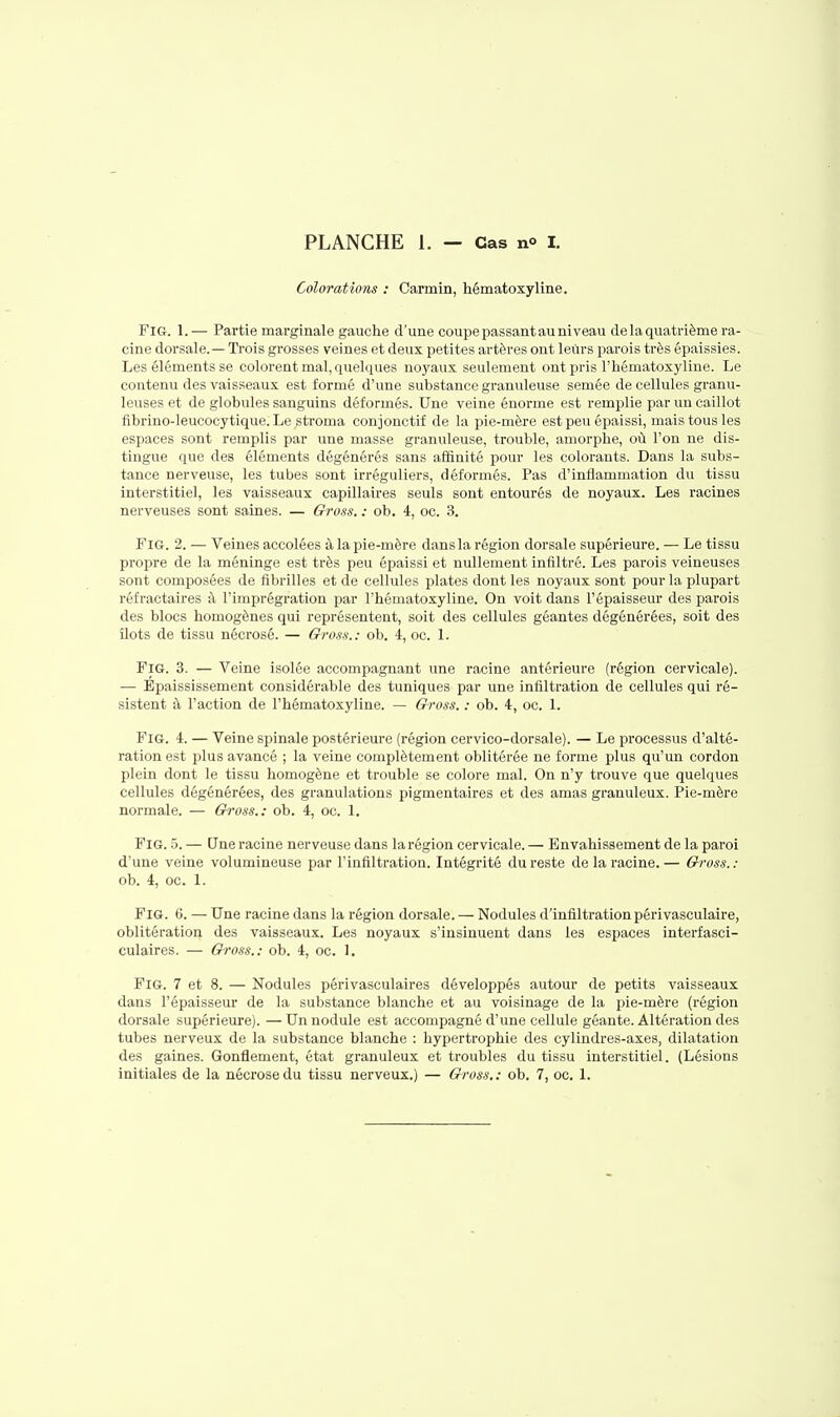 Colorations : Carmin, hématoxyline. FiG. 1.— Partie marginale gauche d'une coupe passant au niveau de la quatrième ra- cine dorsale.— Trois grosses veines et deux petites artères ont leurs parois très épaissies. Les éléments se colorent mal, quelques noyaux seulement ont pris l'hématoxyline. Le contenu des vaisseaux est formé d'une substance granuleuse semée de cellules granu- leuses et de globules sanguins déformés. Une veine énorme est remplie par un caillot fibrino-leucocytique. Le sti'oma conjonctif de la pie-mère est peu épaissi, mais tous les espaces sont remplis par une masse granuleuse, trouble, amorphe, où l'on ne dis- tingue que des éléments dégénérés sans affinité pour les colorants. Dans la subs- tance nerveuse, les tubes sont irréguliers, déformés. Pas d'inflammation du tissu interstitiel, les vaisseaux capillaires seuls sont entourés de noyaux. Les racines nerveuses sont saines. — Choss. : ob. 4, oc. 3. FiG. 2. — Veines accolées à la pie-mère dans la région dorsale supérieure. — Le tissu propre de la méninge est très peu épaissi et nullement infiltré. Les parois veineuses sont composées de fibrilles et de cellules plates dont les noyaux sont pour la plupart réfractaires à l'imprégration par l'hématoxyline. On voit dans l'épaisseur des parois des blocs homogènes qui représentent, soit des cellules géantes dégénérées, soit des îlots de tissu nécrosé. — Gross.: ob. 4, oc. 1. FiG. 3. — Veine isolée accompagnant une racine antérieure (région cervicale). — Epaississement considérable des tuniques par une infiltration de cellules qui ré- sistent à l'action de l'hématoxyline. — Gross. : ob. 4, oc. 1. FiG. 4. — Veine spinale postérieure (région cervico-dorsale). — Le processus d'alté- ration est plus avancé ; la veine complètement oblitérée ne forme plus qu'un cordon plein dont le tissu homogène et trouble se colore mal. On n'y trouve que quelques cellules dégénérées, des granulations pigmentaires et des amas granuleux. Pie-mère normale. — Gi'oss.: ob. 4, oc. 1. FiG. 5. — Une racine nerveuse dans la région cervicale. — Envahissement de la paroi d'une veine volumineuse par l'infiltration. Intégrité du reste de la racine. — Gross. : ob. 4, oc. 1. FiG. G. — Une racine dans la région dorsale. — Nodules d'infiltration périvasculaire, oblitération des vaisseaux. Les noyaux s'insinuent dans les espaces interfasci- culaires. — Gross.: ob. 4, oc. 1. FiG. 7 et 8. — Nodules périvasculaires développés autour de petits vaisseaux dans l'épaisseur de la substance blanche et au voisinage de la pie-mère (région dorsale supérieure). —Un nodule est accompagné d'une cellule géante. Altération des tubes nerveux de la substance blanche : hypertrophie des cylindres-axes, dilatation des gaines. Gonflement, état granuleux et troubles du tissu interstitiel. (Lésions initiales de la nécrose du tissu nerveux.) — Gross.: ob. 7, oc. \.