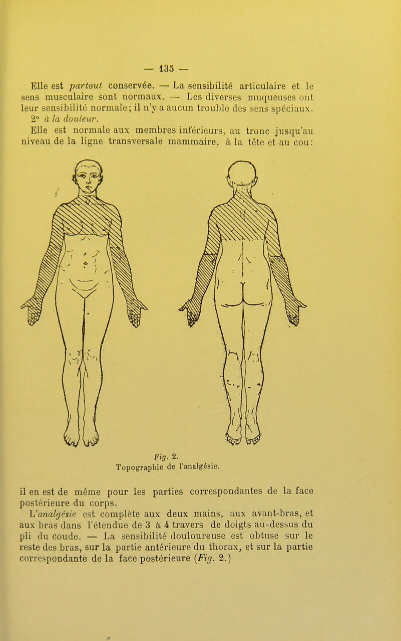 Elle est partout conservée. — La sensibilité articulaire et le sens musculaire sont normaux, — Les diverses muqueuses ont leur sensibilité normale; il n'y a aucun trouble des sens spéciaux. 2 à la douleur. Elle est normale aux membres inférieurs, au tronc jusqu'au niveau de la ligne transversale mammaire, à la tête et au cou: Fig. 2. Topographie de l'analgésie. il en est de même pour les parties correspondantes de la face postérieure du corps. Vanalgésie est complète aux deux mains, aux avant-bras, et aux bras dans l'étendue de 3 à 4 travers de doigts au-dessus du pli du coude. — La sensibilité douloureuse est obtuse sur le reste des bras, sur la partie antérieure du thorax, et sur la partie correspondante de la face postérieure {Fig. 2.)