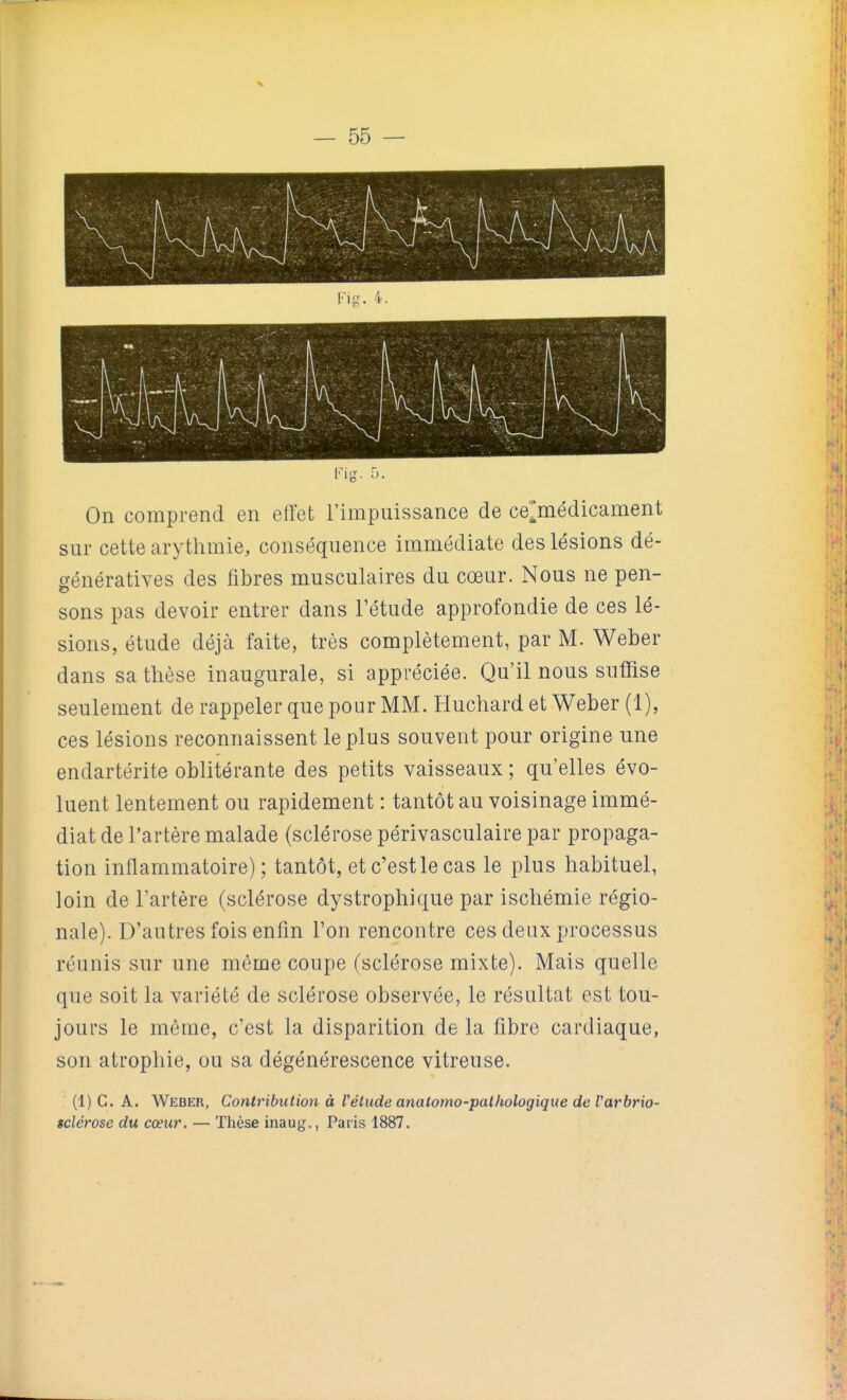 — 55 — Fig. 5. On comprend en effet l'impuissance de ce^médicament sur cette arythmie, conséquence immédiate des lésions dé- génératives des fibres musculaires du cœur. Nous ne pen- sons pas devoir entrer dans l'étude approfondie de ces lé- sions, étude déjà faite, très complètement, par M. Weber dans sa thèse inaugurale, si appréciée. Qu'il nous suffise seulement de rappeler que pour MM. Huchard et Weber (1), ces lésions reconnaissent le plus souvent pour origine une endartérite oblitérante des petits vaisseaux ; qu'elles évo- luent lentement ou rapidement : tantôt au voisinage immé- diat de l'artère malade (sclérose périvasculaire par propaga- tion inflammatoire); tantôt, et c'est le cas le plus habituel, loin de l'artère (sclérose dystrophique par ischémie régio- nale). D'autres fois enfin l'on rencontre ces deux processus réunis sur une même coupe (sclérose mixte). Mais quelle que soit la variété de sclérose observée, le résultat est tou- jours le môme, c'est la disparition de la fibre cardiaque, son atrophie, ou sa dégénérescence vitreuse. (1) G. A. Weber, Contribution à l'élude analomo-pathologique de Varbrio- êclérose du cœur. — Thèse inaug., Paris 1887.