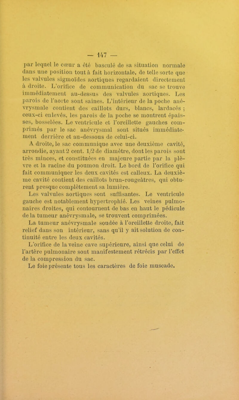 par lequel le cœur a été basculé de sa situation normale dans nue position tout à fait horizontale, de telle sorte que les valvules sigmoïdes aortiques regardaient directement à droite. L'orifice de communication du sac se trouve immédiatement au-dessus des valvules aortiques. Les parois de l’aorte sont saines. L’intérieur de la poche ané- vrysmale contient des caillots durs, blancs, lardacés ; ceux-ci enlevés, les parois de la poche se montrent épais- ses, bosselées. Le ventricule et l’oreillette gauches com- primés par le sac anévrysmal sont situés immédiate- ment derrière et au-dessous de celui-ci. A droite, le sac communique avec une deuxième cavité, arrondie, ayant 2 cent. 1/2 de diamètre, dont les parois sont très minces, et constituées en majeure partie par la plè- vre et la racine du poumon droit. Le bord de l’oritice qui fait communiquer les deux cavités est calleux. La deuxiè- me cavité contient des caillots brun-rougeâtres, qui obtu- rent presque complètement sa lumière. Les valvules aortiques sont suffisantes. Le ventricule gauche est notablement hypertrophié. Les veines pulmo- naires droites, qui contournent de bas en haut le pédicule de la tumeur anévrysmale, se trouvent comprimées. La tumeur anévrysmale soudée à l’oreillette droite, fait relief dans son intérieur, sans qu’il y ait solution de con- tinuité entre les deux cavités. L’orifice de la veine cave supérieure, ainsi que celui de l’artère pulmonaire sont manifestement rétrécis par l’effet de la compression du sac. Le foie présente tous les caractères de foie muscade.