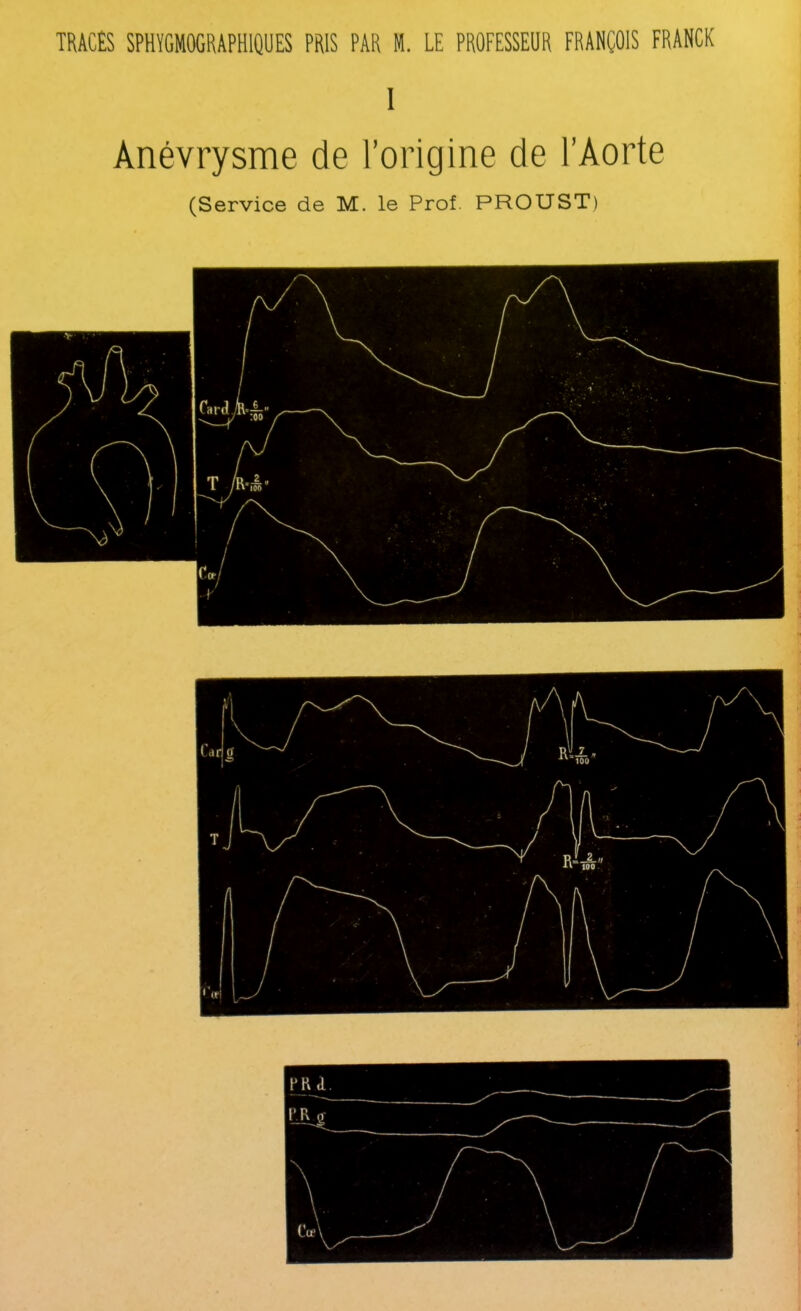 TRACÉS SPH VGMOGR AP H1QU ES PRIS PAR M. LE PROFESSEUR FRANÇOIS FRANCK I Anévrysme de l’origine de l’Aorte (Service de M. le Prof. PROUST)