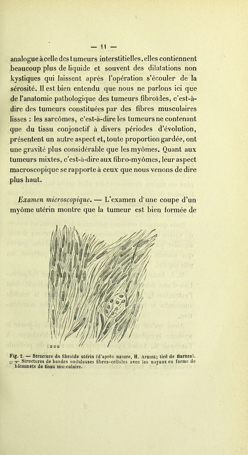 analogue à celle des tumeurs interstitielles, elles contiennent beaucoup plus de liquide et souvent des dilatations non kystiques qui laissent après l’opération s’écouler de la sérosité. Il est bien entendu que nous ne parlons ici que de l’anatomie pathologique des tumeurs fibroïdes, c’est-à- dire des tumeurs constituées par des fibres musculaires lisses : les sarcomes, c’est-à-dire les tumeurs ne contenant que du tissu conjonctif à divers périodes d’évolution, présentent un autre aspect et, toute proportion gardée, ont une gravité plus considérable que lesmyômes. Quant aux tumeurs mixtes, c’est-à-dire aux fibro-myômes, leur aspect macroscopique se rapporte à ceux que nous venons de dire plus haut. Examen microscopique.— L’examen d’une coupe d’un myôme utérin montre que la tumeur est bien formée de Fig. 2. — Structure du fibroïde utérin (d'après nature, H. Arnou; tiré de Barnes). ê'-t Structures débandés ondukuses fibres-cellules avec les noyaux en forme de bâtonnets de tissu musculaire.