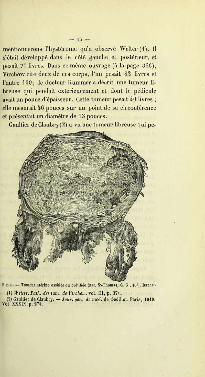 mentionnerons l’hystérôme qu’à observé Welter(l). Il s’était développé dans le côté gauche et postérieur, et pesait 71 livres. Dans ce même ouvrage (à la page 36G), Virchow cite deux de ces corps, l’un pesait 82 livres et l’autre 100; le docteur Kummer a décrit une tumeur fi- breuse qui pendait extérieurement et dont le pédicule avait un pouce d’épaisseur. Cette tumeur pesait 40 livres ; elle mesurait 46 pouces sur un point de sa circonférence et présentait un diamètre de 13 pouces. Gaultier deClaubry(2) a vu une tumeur fibreuse qui pe- Fig. 5. — Tumeur utérine ossifiée ou crétifiée (nat. S'-Thomas, G. G., 402). Barnes (1) Welter. Path. des tum. de Virchow, vol. III, p. 371. (2) Gaultier de Claubry. — Jour. gën. de méd. de Sedillot. Paris, 1810. Yol. XXXIX, p. 271.