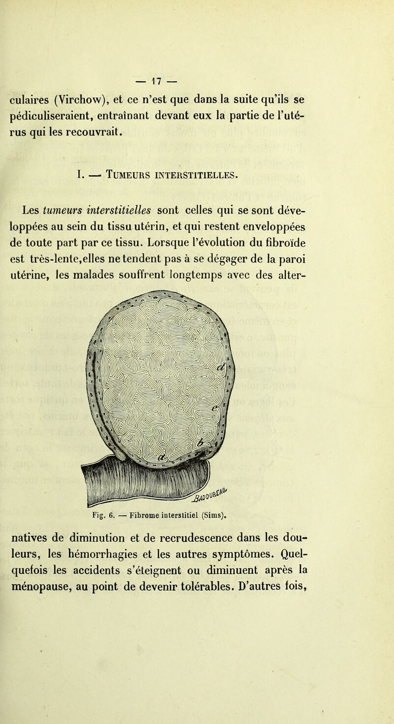 culaires (Virchow), et ce n’est que dans la suite qu’ils se pédiculiseraient, entraînant devant eux la partie de l’uté- rus qui les recouvrait. I. — Tumeurs interstitielles. Les tumeurs interstitielles sont celles qui se sont déve- loppées au sein du tissu utérin, et qui restent enveloppées de toute part par ce tissu. Lorsque l’évolution du fibroïde est très-lente,elles ne tendent pas à se dégager de la paroi utérine, les malades souffrent longtemps avec des alter- natives de diminution et de recrudescence dans les dou- leurs, les hémorrhagies et les autres symptômes. Quel- quefois les accidents s’éteignent ou diminuent après la ménopause, au point de devenir tolérables. D’autres fois,