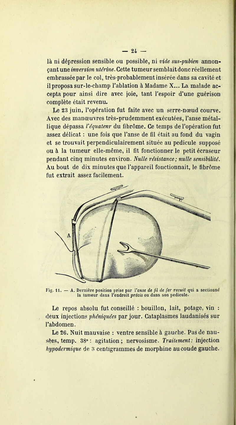 là ni dépression sensible ou possible, ni vide sus-pubien annon- çant une inversion utérine. Cette tumeur semblait donc réellement embrassée par le col, très-probablement insérée dans sa cavité et il proposa sur-le-champ l’ablation à Madame X... La malade ac- cepta pour ainsi dire avec joie, tant l’espoir d’une guérison complète était revenu. Le 23 juin, l’opération fut faite avec un serre-nœud courve. Avec des manœuvres très-prudemment exécutées, l’anse métal- lique dépassa Véquateur du fibrôme. Ce temps de l’opération fut assez délicat : une fois que l’anse de fil était au fond du vagin et se trouvait perpendiculairement située au pédicule supposé ou à la tumeur elle-même, il fit fonctionner le petit écraseur pendant cinq minutes environ. Nulle résistance; nulle sensibilité. Au bout de dix minutes que l’appareil fonctionnait, le fibrôme fut extrait assez facilement. Le repos absolu fut conseillé : bouillon, lait, potage, vin : deux injections phéniquées par jour. Cataplasmes laudanisés sur l’abdomen. Le 26. Nuit mauvaise : ventre sensible à gauche. Pas de nau- sées, temp. 38°: agitation; nervosisme. Traitement: injection hypodermique de 3 centigrammes de morphine au coude gauche.