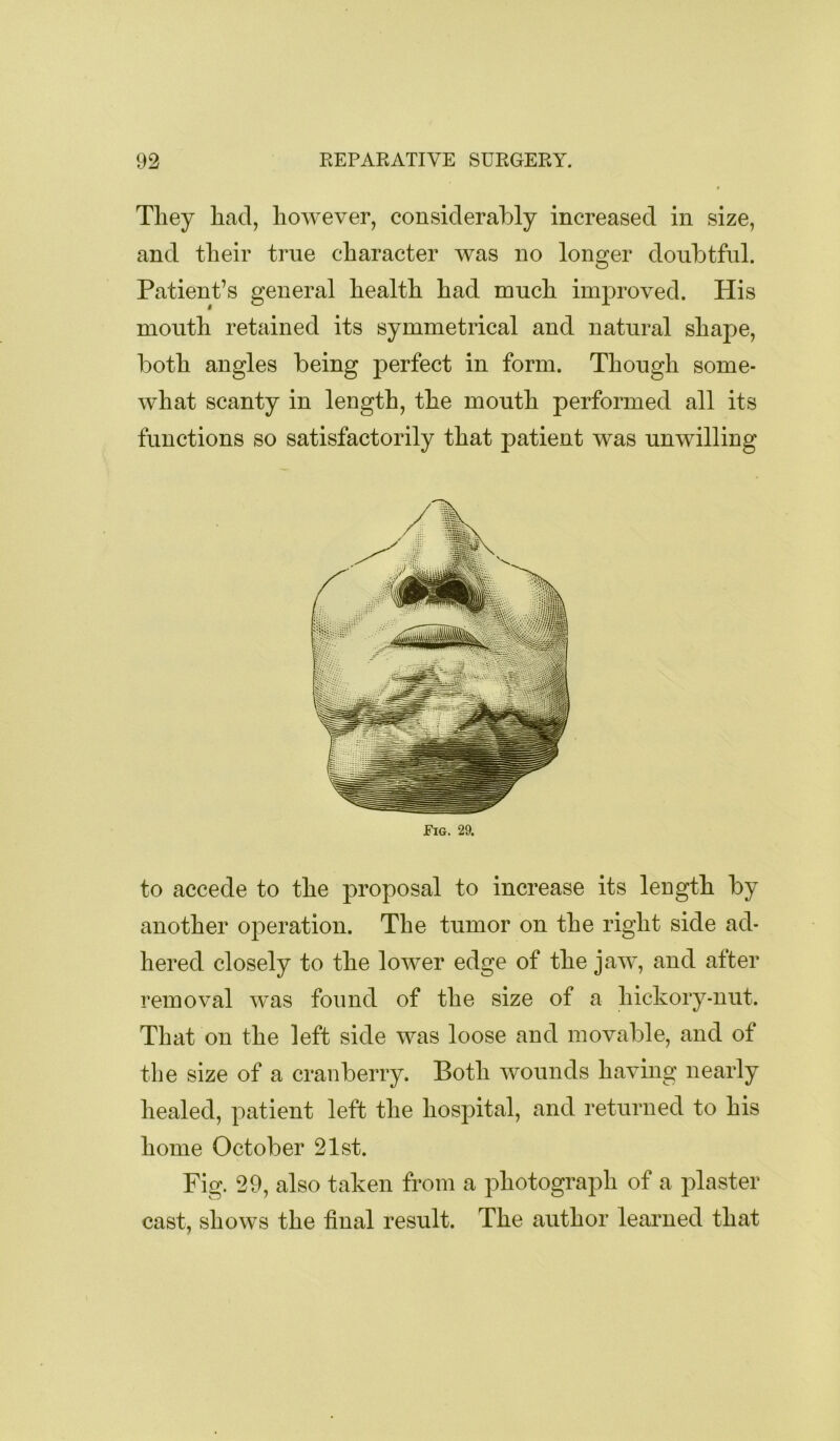 They had, however, considerably increased in size, and their true character was no longer donbtfnl. Patient’s general health had much improved. His mouth retained its symmetrical and natural shape, both angles being perfect in form. Though some- what scanty in length, the mouth performed all its functions so satisfactorily that patient was unwilling Fig. 29. to accede to the proposal to increase its length by another operation. The tumor on the right side ad- hered closely to the lower edge of the jaw, and after removal w^as found of the size of a hickory-nut. That on the left side was loose and movable, and of the size of a cranberry. Both wounds having nearly healed, patient left the hospital, and returned to his home October 21st. Fig. 29, also taken from a photograph of a plaster cast, shows the final result. The author learned that