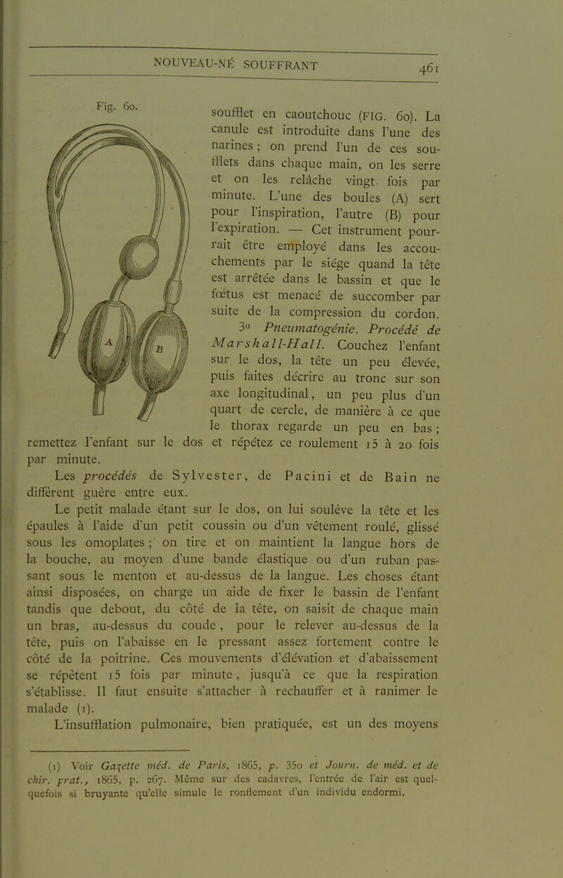 soufflet en caoutchouc (FIG. 60). La canule est introduite dans l'une des narines ; on prend l'un de ces sou- fflets dans chaque main, on les serre et on les relâche vingt- fois par minute. L'une des boules (A) sert pour l'inspiration, l'autre (B) pour l'expiration. — Cet instrument pour- rait être employé' dans les accou- chements par le siège quand la tête est arrêtée dans le bassin et que le foetus est menacé de succomber par suite de la compression du cordon. 3° Pneumatogénie. Procédé de Marshall-Hall. Couchez l'enfant sur le dos, la tête un peu élevée, puis faites décrire au tronc sur son axe longitudinal, un peu plus d'un quart de cercle, de manière à ce que le thorax regarde un peu en bas ; remettez l'enfant sur le dos et répétez ce roulement i5 à 20 fois par minute. Les procédés de Sylvester, de Pacini et de Bain ne diffèrent guère entre eux. Le petit malade étant sur le dos, on lui soulève la tête et les épaules à l'aide d'un petit coussin ou d'un vêtement roulé, ghssé sous les omoplates ; on tire et on maintient la langue hors de la bouche, au moyen d'une bande élastique ou d'un ruban pas- sant sous le menton et au-dessus de la langue. Les choses étant ainsi disposées, on charge un aide de fixer le bassin de l'enfant tandis que debout, du côté de la tête, on saisit de chaque main un bras, au-dessus du coude , pour le relever au-dessus de la tête, puis on l'abaisse en le pressant assez fortement contre le côté de la poitrine. Ces mouvements d'élévation et d'abaissement se répètent 15 fois par minute, jusqu'à ce que la respiration s'établisse. Il faut ensuite s'attacher à rechauffer et à ranimer le malade (i). L'insufflation pulmonaire, bien pratiquée, est un des moyens (1) Voir Galette méd. de Paris, i865, p. 35o et Journ. de méd. et de chir. prat., i865, p. 2G7. Même sur des cadavres, l'entrée de l'air est quel- quefois si bruyante qu'elle simule le ronflement d'un individu endormi.