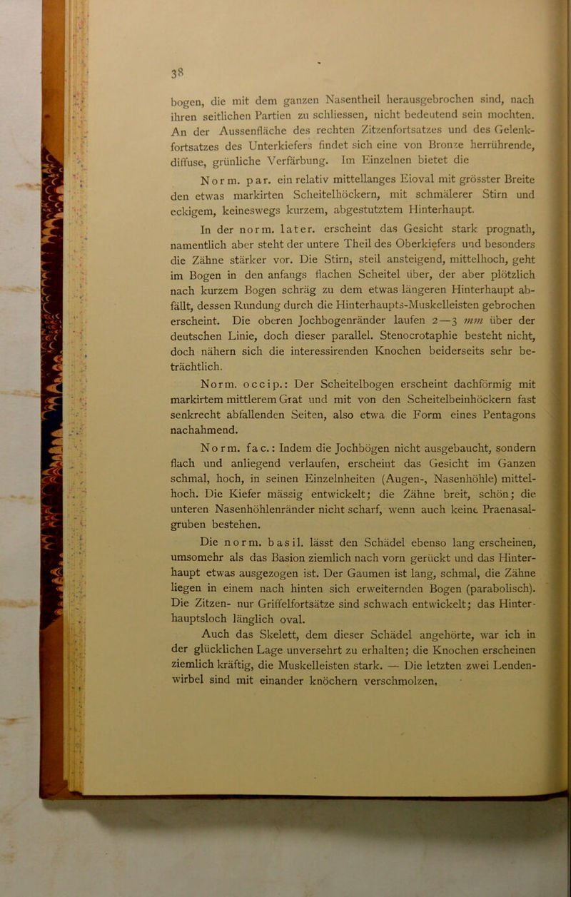 3S bogen, die mit dem ganzen Nasentheil herausgebrochen sind, nach ihren seitlichen Partien zu schliessen, nicht bedeutend sein mochten. An der Aussenfläche des rechten Zitzenfortsatzes und des Gelenk- fortsatzes des Unterkiefers findet sich eine von Bronze herrührende, diffuse, grünliche Verfärbung. Im Einzelnen bietet die Norm. par. ein relativ mittellanges Eioval mit grösster Breite den etwas markirten Scheitelhöckern, mit schmälerer Stirn und eckigem, keineswegs kurzem, abgestutztem Hinterhaupt. In der norm, later, erscheint das Gesicht stark prognath, namentlich aber steht der untere Theil des Oberkiefers und besonders die Zähne stärker vor. Die Stirn, steil ansteigend, mittelhoch, geht im Bogen in den anfangs flachen Scheitel über, der aber plötzlich nach kurzem Bogen schräg zu dem etwas längeren Hinterhaupt ab- fällt, dessen Rundung durch die Hiuterhaupts-Muskelleisten gebrochen erscheint. Die oberen Jochbogenränder laufen 2—3 mm über der deutschen Linie, doch dieser parallel. Stenocrotaphie besteht nicht, doch nähern sich die interessirenden Knochen beiderseits sehr be- trächtlich. Norm, occip.: Der Scheitelbogen erscheint dachförmig mit markirtem mittlerem Grat und mit von den Scheitelbeinhöckern fast senkrecht abfallenden Seiten, also etwa die Form eines Pentagons nachahmend. Norm. fac.: Indem die Jochbögen nicht ausgebaucht, sondern flach und anliegend verlaufen, erscheint das Gesicht im Ganzen schmal, hoch, in seinen Einzelnheiten (Augen-, Nasenhöhle) mittel- hoch. Die Kiefer mässig entwickelt; die Zähne breit, schön; die unteren Nasenhöhlenränder nicht scharf, wenn auch keine Praenasal- gruben bestehen. Die norm, basil. lässt den Schädel ebenso lang erscheinen, umsomehr als das Basion ziemlich nach vorn gerückt und das Hinter- haupt etwas ausgezogen ist. Der Gaumen ist lang, schmal, die Zähne liegen in einem nach hinten sich erweiternden Bogen (parabolisch). Die Zitzen- nur Griffelfortsätze sind schwach entwickelt; das Hinter* hauptsloch länglich oval. Auch das Skelett, dem dieser Schädel angehörte, war ich in der glücklichen Lage unversehrt zu erhalten; die Knochen erscheinen ziemlich kräftig, die Muskelleisten stark. — Die letzten zwei Lenden- wirbel sind mit einander knöchern verschmolzen.