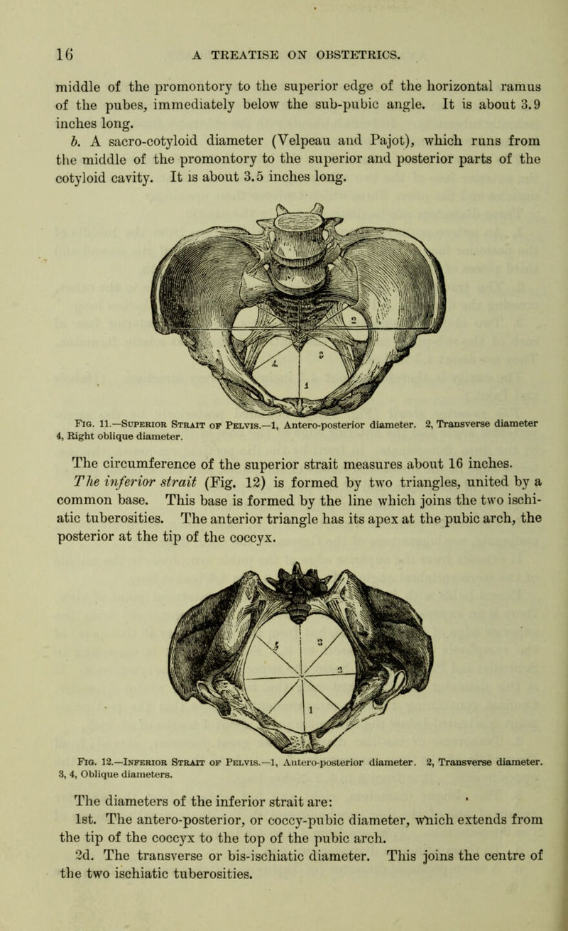 middle of the promontory to the superior edge of the horizontal ramus of the pubes, immediately below the sub-pubic angle. It is about 3.9 inches long. b. A sacro-cotyloid diameter (Velpeau and Pajot), which runs from the middle of the promontory to the superior and posterior parts of the cotyloid cavity. It is about 3.5 inches long. Fig. 11.—Superior Strait of Pelvis.—1, Antero-posterior diameter. 2, Transverse diameter 4, Right oblique diameter. The circumference of the superior strait measures about 16 inches. The inferior strait (Fig. 12) is formed by two triangles, united by a common base. This base is formed by the line which joins the two ischi- atic tuberosities. The anterior triangle has its apex at the pubic arch, the posterior at the tip of the coccyx. Fig. 12.—Inferior Strait of Pelvis.—1, Antero-posterior diameter. 2, Transverse diameter. 3, 4, Oblique diameters. The diameters of the inferior strait are: 1st. The antero-posterior, or coccy-pubic diameter, which extends from the tip of the coccyx to the top of the pubic arch. 2d. The transverse or bis-ischiatic diameter. This joins the centre of the two ischiatic tuberosities.