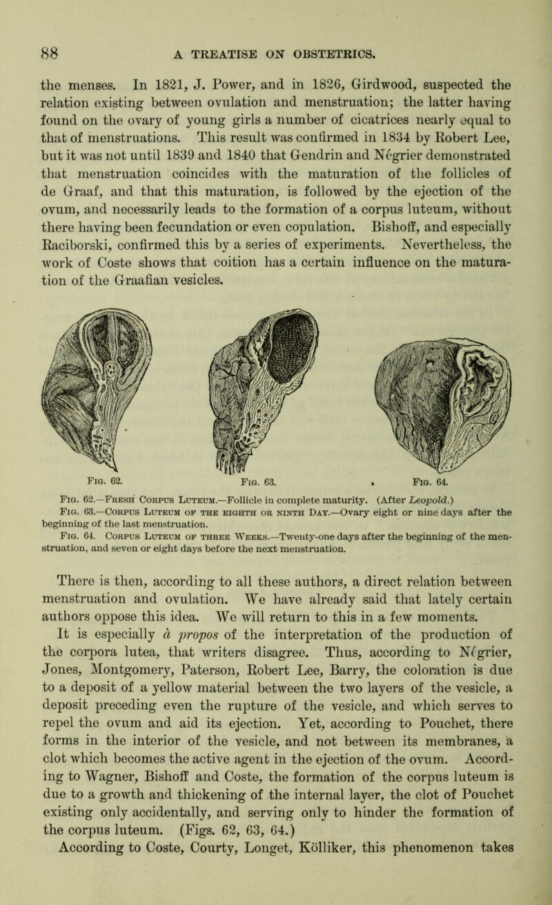 the menses. In 1821, J. Power, and in 1826, Girdwood, suspected the relation existing between ovulation and menstruation; the latter having found on the ovary of young girls a number of cicatrices nearly equal to that of menstruations. This result was confirmed in 1834 by Robert Lee, but it was not until 1839 and 1840 that Gendrin and Negrier demonstrated that menstruation coincides with the maturation of the follicles of de Graaf, and that this maturation, is followed by the ejection of the ovum, and necessarily leads to the formation of a corpus luteum, without there having been fecundation or even copulation. Bishoff, and especially Raciborski, confirmed this by a series of experiments. Nevertheless, the work of Coste shows that coition has a certain infiuence on the matura- tion of the Graafian vesicles. Fig. 62. Fig. 63. Fig. 64. Fig. 62.—Fresh Corpus Luteum.—Follicle in complete maturity. (After Leopold.) Fig. 63.—Corpus Luteum op the eighth or ninth Day.—Ovary eight or nine days after the beginning of the last menstruation. Fig. 64. Corpus Luteum op three Weeks.—Twenty-one days after the beginning of the men- struation, and seven or eight days before the next menstruation. There is then, according to all these authors, a direct relation between menstruation and ovulation. We have already said that lately certain authors oppose this idea. We will return to this in a few moments. It is especially a propos of the interpretation of the production of the corpora lutea, that writers disagree. Thus, according to Ntgrier, Jones, Montgomery, Paterson, Robert Lee, Barry, the coloration is due to a deposit of a yellow material between the two layers of the vesicle, a deposit preceding even the rupture of the vesicle, and which serves to repel the ovum and aid its ejection. Yet, according to Pouchet, there forms in the interior of the vesicle, and not between its membranes, a clot which becomes the active agent in the ejection of the ovum. Accord- ing to Wagner, Bishoff and Coste, the formation of the corpus luteum is due to a growth and thickening of the internal layer, the clot of Pouchet existing only accidentally, and serving only to hinder the formation of the corpus luteum. (Figs. 62, 63, 64.) According to Coste, Courty, Longet, Kolliker, this phenomenon takes