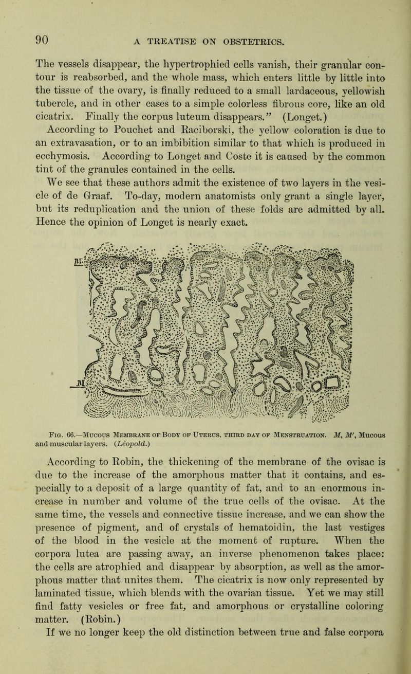The vessels disappear, the hypertrophied cells vanish, their granular con- tour is reabsorbed, and the whole mass, which enters little by little into the tissue of the ovary, is finally reduced to a small lardaceous, yellowish tubercle, and in other cases to a simple colorless fibrous core, like an old cicatrix. Finally the corpus luteum disappears. (Longet.) According to Pouchet and liaciborski, the yellow coloration is due to an extravasation, or to an imbibition similar to that which is produced in ecchymosis. According to Longet and Coste it is caused by the common tint of the granules contained in the cells. We see that these authors admit the existence of two layers in the vesi- cle of de Graaf. To-day, modern anatomists only grant a single layer, but its reduplication and the union of these folds are admitted by alL Hence the opinion of Longet is nearly exact. Fig. 66.—Mucous Membrane of Body op Uterus, third day of Menstruation. M, M\ Mucous and muscular layers. {Leopold.) According to Robin, the thickening of the membrane of the ovisac is due to the increase of the amorphous matter that it contains, and es- pecially to a deposit of a large quantity of fat, and to an enormous in- crease in number and volume of the true cells of the ovisac. At the same time, the vessels and connective tissue increase, and we can show the presence of pigment, and of crystals of hematoidin, the last vestiges of the blood in the vesicle at the moment of rupture. When the corpora lutea are passing away, an inverse phenomenon takes place: the cells are atrophied and disappear by absorption, as well as the amor- phous matter that unites them. Tfiie cicatrix is now only represented by laminated tissue, which blends with the ovarian tissue. Yet we may still find fatty vesicles or free fat, and amorphous or crystalline coloring matter. (Robin.) If we no longer keep the old distinction between true and false corpora
