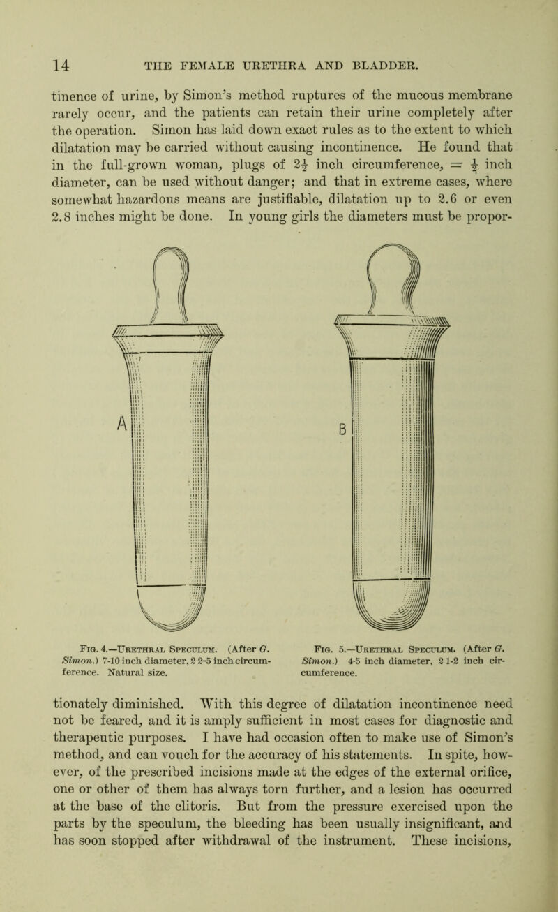 tinence of urine, by Simonas method ruptures of the mucous membrane rarely occur, and the patients can retain their urine completely after the operation. Simon has laid down exact rules as to the extent to which dilatation may be carried without causing incontinence. He found that in the full-grown woman, plugs of 2^ inch circumference, = i inch diameter, can be used without danger; and that in extreme cases, where somewhat hazardous means are justifiable, dilatation up to 2.6 or even 2.8 inches might be done. In young girls the diameters must be propor- Fig. 4.—Urethral Speculum. (After G. Fig. 5.—Urethral Speculum. (After G. Simon.) 7-10 inch diameter, 2 2-5 inchcircum- Simon.) 4-5 inch diameter, 21-2 inch cir- ference. Natural size. cumference. tionately diminished. With this degree of dilatation incontinence need not be feared, and it is amply sufficient in most cases for diagnostic and therapeutic purposes. I have had occasion often to make use of Simonas method, and can vouch for the accuracy of his statements. In spite, how- ever, of the prescribed incisions made at the edges of the external orifice, one or other of them has always torn further, and a lesion has occurred at the base of the clitoris. But from the pressure exercised upon the parts by the speculum, the bleeding has been usually insignificant, and has soon stopped after withdrawal of the instrument. These incisions.