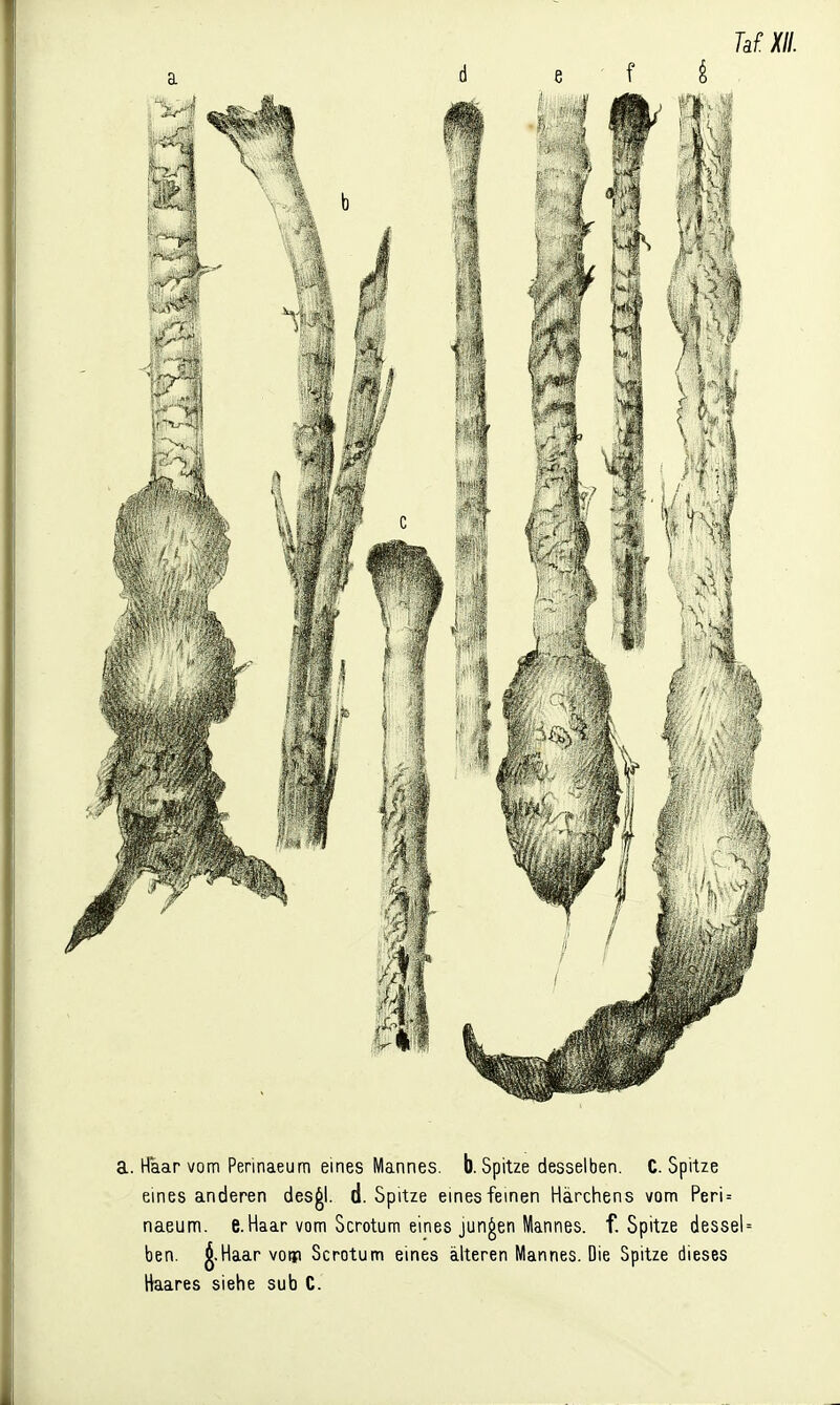 TdXII. d e • f ^ a. Haar vom Perinaeum eines Mannes, b. Spitze desselben. C.Spitze eines anderen des^l. d. Spitze eines feinen Härchens vom Peri = naeum. e.Haar vom Scrotum eines jungen Mannes, f. Spitze desseU ben. ^.Haar votji Scrotum eines älteren Mannes. Die Spitze dieses Haares siehe sub C.