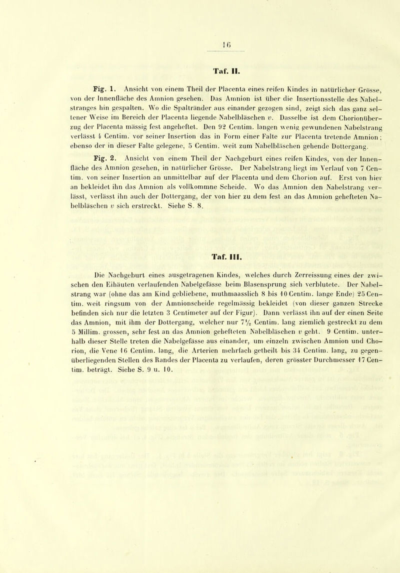 IG Tat. II. Fig. 1. Ansicht von einem Theil der Placenla eines reifen Kindes in natürlicher Grösse, von der Innenfläche des Amnion gesehen. Das Amnion ist über die Inserlionsslelle des Nabel- stranges hin gespalten. Wo die Spaltränder aus einander gezogen sind, zeigt sich das ganz sel- tener Weise im Bereich der Placenta liegende Nabelbläschen v. Dasselbe ist dem Chorionüber- zug der Placenta massig fest angeheflet. Den 92 Centim. langen wenig gewundenen Nabelstrang verlässt i Centim. vor seiner Insertion das in Form einer Falte zur Placenta tretende Amnion ; ebenso der in dieser Falte gelegene, 5 Centim. weit zum Nabelbläschen gehende Dottergang. Fig. 2. Ansicht von einem Theil der Nachgeburt eines reifen Kindes, von der Innen- fläche des Amnion gesehen, in natürlicher Grösse. Der Nabelstrang liegt im Verlauf von 7 Cen- tim. von seiner Insertion an unmittelbar auf der Placenta und dem Chorion auf. Erst von hier an bekleidet ihn das Amnion als vollkommne Scheide. Wo das Amnion den Nabelstrang ver- lässt, verlässt ihn auch der Doltergang, der von hier zu dem fest an das Amnion gehefteten Na- belbläschen v sich erstreckt. Siehe S. 8. Taf. III. Die Nachgeburt eines ausgetragenen Kindes, welches durch Zerreissung eines der zwi- schen den Eihäuten verlaufenden Nabelgefässe beim Blasensprung sich verblutete. Der Nabel- strang war (ohne das am Kind gebliebene, muthmaasslich 8 bis 10 Centim. lange Ende) 25 Cen- tim. weit ringsum von der Amnionscheide regelmässig bekleidet (von dieser ganzen Strecke befinden sich nur die letzten 3 Centimeter auf der Figur). Dann verlässt ihn auf der einen Seite das Amnion, mit ihm der Dottergang, welcher nur 7% Centim. lang ziemlich gestreckt zu dem 5 Millim. grossen, sehr fest an das Amnion gehefteten Nabelbläschen v geht. 9 Centim. unter- halb dieser Stelle treten die Nabelgefässe aus einander, um einzeln zwischen Amnion und Cho- rion, die Vene 16 Centim. lang, die Arterien mehrfach getheilt bis 34 Centim. lang, zu gegen- überliegenden Stellen des Randes der Placenta zu verlaufen, deren grösster Durchmesser 17 Cen-