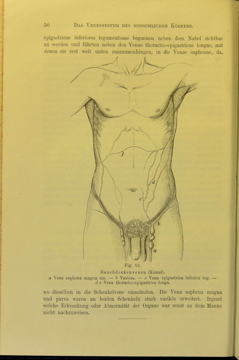 epigastricae inferiores tegumentosae begannen neben dem Nabel sichtbar zu werden und fühi-ten neben den Venae thoracico-epigastricae longae, mit denen sie erst weit unten zusammenhingen, in die Venae saphenae, da, d e Vena thoracico-epigastrica longa. WO dieselben in die Schenkelvene einmünden. Die Vena saphena magna und parva waren an beiden Schenkeln stark varikös erweitert. Irgend welche Erkrankung oder Abnormität der Organe war sonst an dem Manne nicht nachzuweisen.