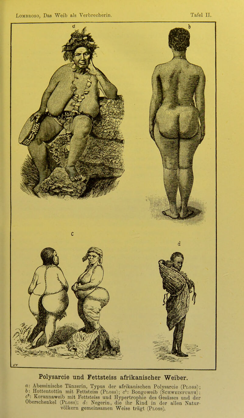 C d \lr. Polysarcie und Fettsteiss afrikanischer Weiber. ffl: Abessinische Tänzerin, Typus der afrikanischen Polysarcie (Ploss); 6: Hottentottin mit Fettsteiss (Ploss); c*: Bongoweib (Sohweinfurth); c*: Korannaweib mit Fettsteiss und Hypertrophie des Qesässes und der Oberschenkel (Ploss); il: Negerin, die ihr Kind in der allen Natur- völkern gemeinsamen Weise trägt (Ploss),