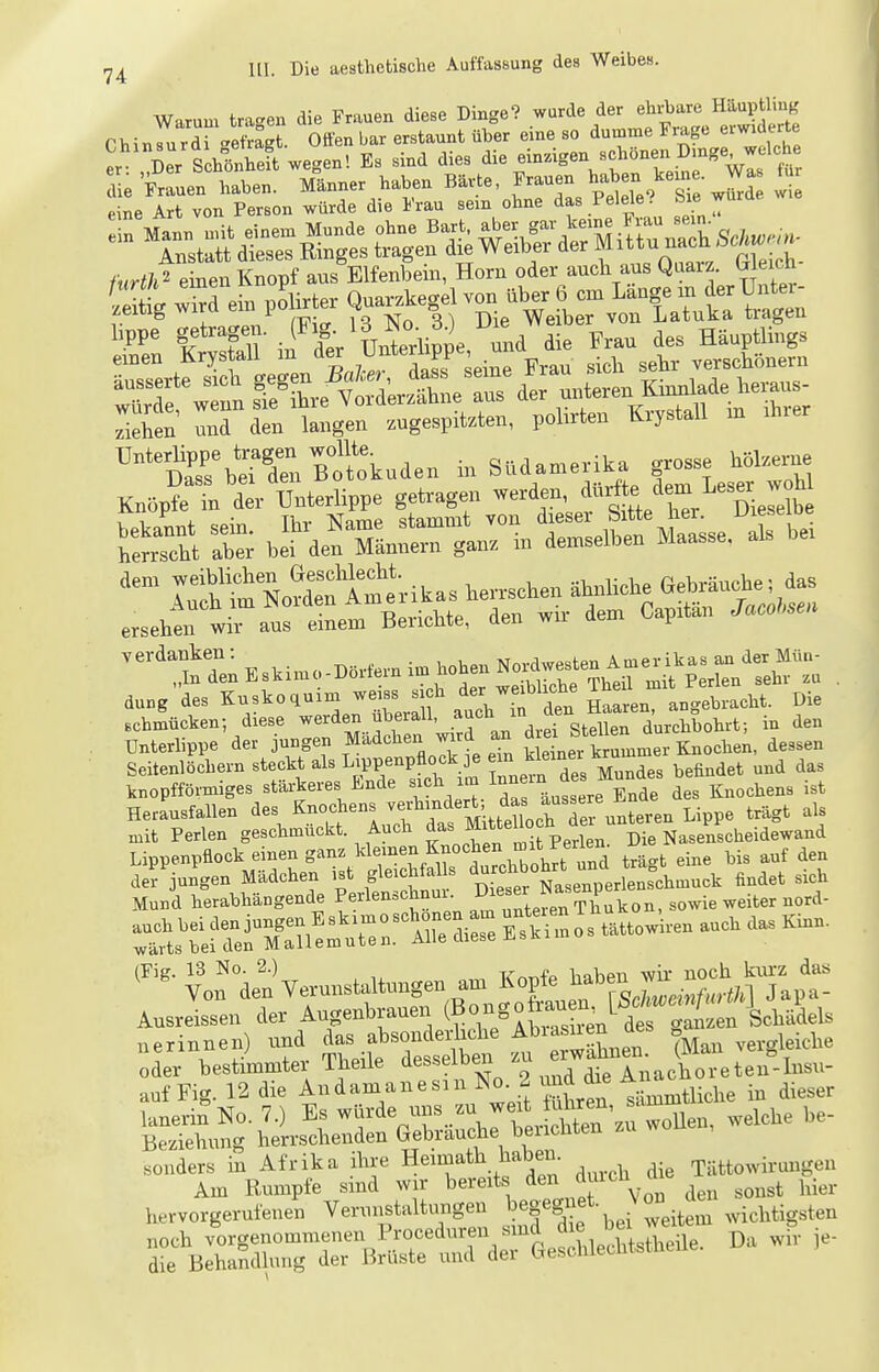J^ III. Di, «e>fteti8che Auftoong des Weibe». Warum to«n die Frauen diese Binge? wurde der ehrbare Hiuptliuß r b i„I,,Tdi «ftit Offeu bar erstaunt Ober eine .o dumme Frage erwiderte .!^:r S hÄ wegenl E. .lud die. .11= •-'S» eh»»» ^»«'^^.''t 2l:e^irÄ.s:'dÄu^^^:eLTr„^ 3 den t,ge„ zugespitzten, polirteu Krystall m threr TbÄBtokuden i„ Südamerika grosse Mkerue Knopfe ta der UoterUppe getragen werden, I^Xreft Ä = .Ärtarin^SseCie.^ .ei CftaNorfen Amerikas herrschen ähnliche Gehränche; das erseht wra!r;Lt Berichte, den wir den, Caprtän Äcote« '*tTen E,.ime-B.r,eru.m beben N—^^^^^ dung des Kuskoquim weiss sich d«»; ^IJ^'^^n angebracht. Die schmücken; diese werden überall, !ll'\^\^\SZ ^^Jllol..t-, in den Unterlippe der jungen Madchen ward an di^^J^^J^^^^^ ^,,i,en, dessen Seitenlöchern steckt als luppenpfl^^^^^^^^^ ^as knopfförmiges stärkeres Ende ^^«^ Ende des Knochens ist Herausfallen Lippe trägt als mit Perlen geschmückt Auch J^^J^^^ p^^^g^ Die Nasenscheidewand Lippenpflock einen S^^\^^'}^'l^^''^Z2oh^^^^^ trägt eine bis auf den -SSÄ^OS tättowlren auch das Kinn. ^^V—— ^^^^ Oder bestimmter Theüe desselben zu exwahn^^^^ auf Fig. 12 die Andamanesni No. 2 und d e ^ • ^-^^^^ lanerin^No. 7.) Es würde uns zu we^^^ iu^^^^^^^ ^^^^^^ Beziehung herrschenden Gebrauche belichten «onders in Afrika ihre Heimath haben. Tättowirungen Am Rumpfe sind wir bereits den ^uicu q ^^^^ ^^^^^ j^.^^. hervorgerufenen Verunstaltungen begegnet. .vichtigsten noch vorgenommenen Proceduren sind die b^^^^^^^ die Behandhing der Brüste und der Geschieclitstne