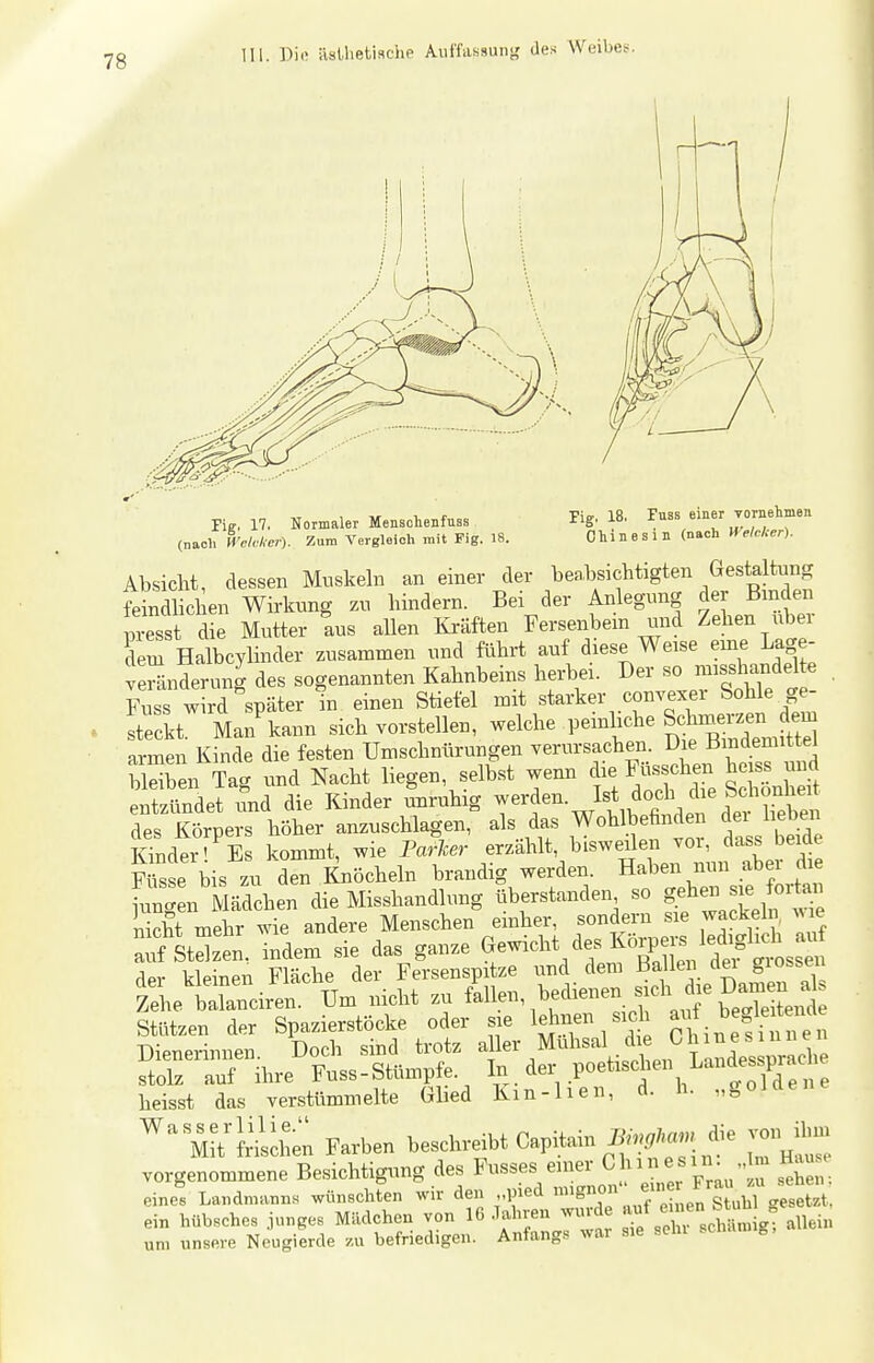 Fig. 17. Normaler Mensohenfuss (nach H'ehlier). Zum Vergleich mit Fig. 18. Fig. 18. Fuss einer vornelimen Chinesin (nach Welcher). Ab,sicM, dessen Muskeln an einer der beabsichtigten Gestaltung feindlichen Wirkung zu hindern. Bei der Anlegung der Emden Cst die Mutter aus allen Mten Fersenbein mid Zehen über em Halbcylinder zusammen und führt auf diese Weise eme Lage- ve^änderun^ des sogenannten Kahnbeins herbei. Der so misshandelte Fuss wird später in einen Stiefel mit starker convexer Sohle ge- eckt Man'kann sich vorstellen, welche V^^^^^ ^^J^^^^J^, armen Kinde die festen Umschnürungen verursachen. Die Bindemittel S n Tag und Nacht liegen, selbst wenn die Füsschen heiss und entzündet und die Kinder Unruhig --f-Jtlb t'den^^'neben des Körpers höher anzuschlagen, als das Wohlbefinde l^^^en Kinder' Es kommt, wie Parlier erzählt, bisweilen voi, dass beiae Füs e bis zu den Knöcheln brandig werden. Haben nun aber die ^mg n Mädchen die Misshandlung überstanden so ge^ien - ^ nicht mehr wie andere Menschen emher, sondern sie vrackeln, ^^le ÄSzen. indem sie das ganze ^^e-^^^V^T'''Ki dÄ der kleinen Fläche der Fersenspitze und dem Ballen dei giossen Zehe brnciren. Um nicht zu Mlen, bedienen sich di^ Stützen der Spazierstöcke oder sie lehnen sich ~ Dienerinnen. Doch sind trotz f • ^^^„f L.ndes^S^^^ stolz auf ihre Fuss-Stümpfe. In. der poetischen Landessprac i heisst das verstümmelte Glied Km-lien, d. h. „goJüene MH friichen Farben beschreibt Capitain ^/«./^^clie vorgenommene Besichtigung des Fusses einer Chniesn ^ m Hau eine? Landnv.nn« wünschten wir den pied ''g- J'^^ ^//sT„tT geS^^^^^^^ ein hübBches junges Mädchen von 16 Jahren w.irde ^/ ^-^^^J « .^ein un. unsere Neugierde zu befriedigen. Anfangs war sie sein g,