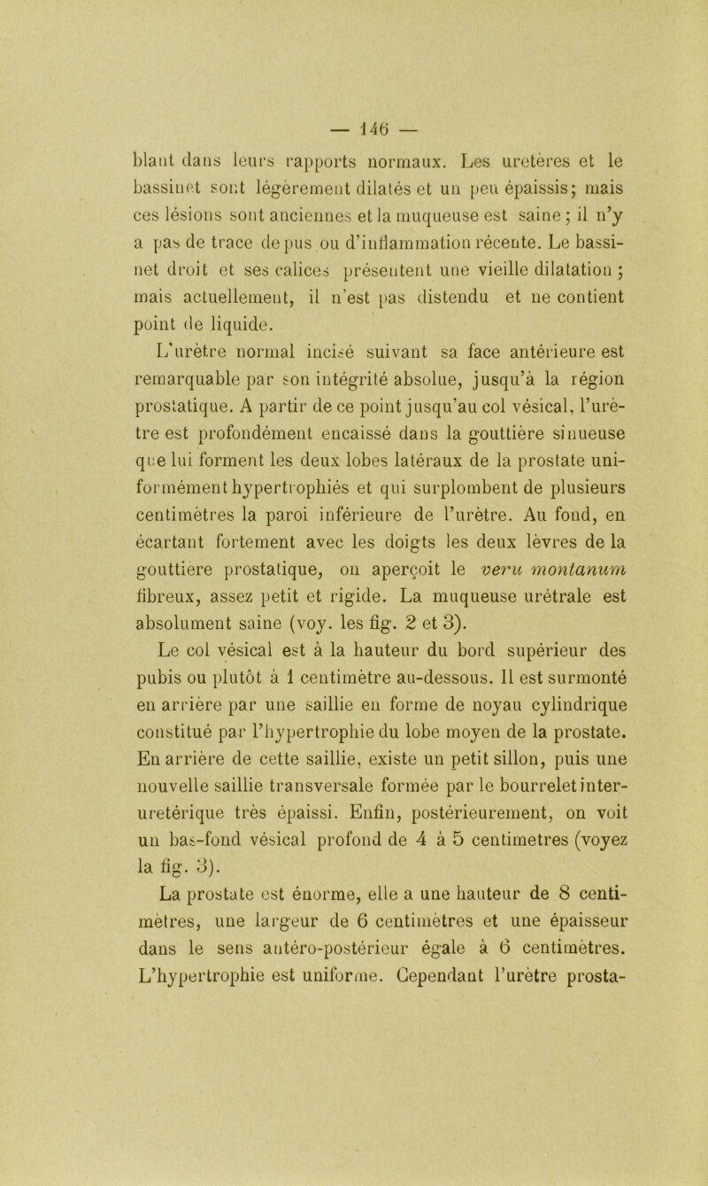 blaiit dans leurs rapports normaux. Les uretères et le bassinet sont légèrement dilatés et un peu épaissis; mais ces lésions sont anciennes et la muqueuse est saine ; il n’y a pas de trace de pus ou d’indammation récente. Le bassi- net droit et ses calices présentent une vieille dilatation ; mais actuellement, il n’est [>as distendu et ne contient point (le liquide. L'urètre normal incisé suivant sa face antérieure est remarquable par son intégrité absolue, jusqu’à la région prostatique. A partir de ce point jusqu’au col vésical, l’urè- tre est profondément encaissé dans la gouttière sinueuse que lui forment les deux lobes latéraux de la prostate uni- formément hypertrophiés et qui surplombent de plusieurs centimètres la paroi inférieure de l’urètre. Au fond, en écartant fortement avec les doigts les deux lèvres de la gouttière prostatique, on aperçoit le veru montanum fibreux, assez petit et rigide. La muqueuse urétrale est absolument saine (voy. les fig. 2 et 3). Le col vésical est à la hauteur du bord supérieur des pubis ou plutôt à 1 centimètre au-dessous. 11 est surmonté en arrière par une saillie en forme de noyau cylindrique constitué par l’hypertrophie du lobe moyen de la prostate. En arrière de cette saillie, existe un petit sillon, puis une nouvelle saillie transversale formée par le bourreletinter- uretérique très épaissi. Enfin, postérieurement, on voit un bas-fond vésical profond de 4 à 5 centimètres (voyez la fig. 3). La prostate est énorme, elle a une hauteur de 8 centi- mètres, une largeur de 6 centimètres et une épaisseur dans le sens antéro-postérieur égale à 6 centimètres. L’hypertrophie est uniforaie. Cependant l’urètre prosta-