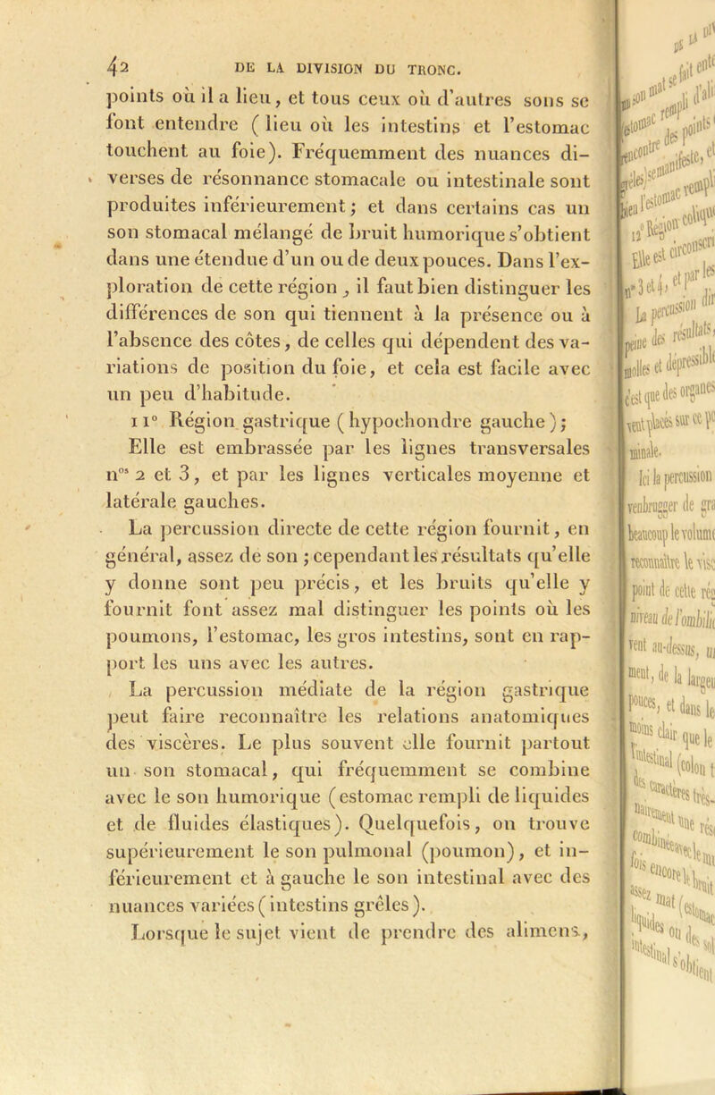 points où il a lieu, et tous ceux où d’autres sons se font entendre ( lieu où les intestins et l’estomac touchent au foie). Fréquemment des nuances di- verses de résonnance stomacale ou intestinale sont produites inférieurement ; et dans certains cas un son stomacal mélangé de bruit humorique s’obtient dans une étendue d’un ou de deux pouces. Dans l’ex- ploration de cette région _, il faut bien distinguer les différences de son qui tiennent à la présence ou à l’absence des côtes, de celles qui dépendent des va- riations de position du foie, et cela est facile avec un peu d’habitude. ii° Région gastrique (hypoehondre gauche); Elle est embrassée par les lignes transversales nos 2 et 3, et par les lignes verticales moyenne et latérale gauches. La percussion directe de cette région fournit, en général, assez de son ; cependant les résultats quelle y donne sont peu précis, et les bruits qu’elle y fournit font assez mal distinguer les points où les poumons, l’estomac, les gros intestins, sont en rap- port les uns avec les autres. La percussion médiate de la région gastrique peut faire reconnaître les relations anatomiques des viscères. Le plus souvent elle fournit partout un son stomacal, qui fréquemment se combine avec le son humorique (estomac rempli de liquides et de fluides élastiques). Quelquefois, on trouve supérieurement le son pulmonal (poumon), et in- férieurement et à gauche le son intestinal avec des nuances variées ( intestins grêles ). Lorsque le sujet vient de prendre des alimens, St .ISlfc'111' 1# V* de5 p»i»,s • |enc°lltl e 'Mp.ef ifeste» ili Ipr fl® • il Elit et les dir la perçu#1011 «ne des résidé dépressihh ■c’est que des organes eulyWés sut eu f1 minale. Ici la percussion venbruscer de gra beaucoup le volume TOMlre le fisc point de cette rce nim del’ombilii Te»t au-dessus, ui ment) de la largeu P0llces> et dans ]* , rstti,|l«le l6W (colon i '“«festrès. COffllji resi mi Sïï- Si* '«ni