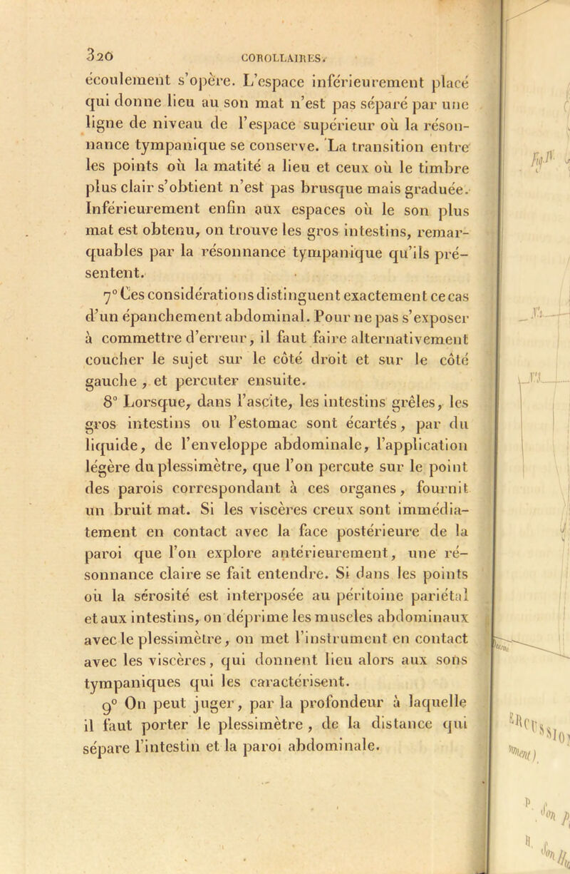 320 écoulement s’opère. L’espace inférieurement placé qui donne lieu au son mat n’est pas séparé par une ligne de niveau de l’espace supérieur où la réson- nance tympanique se conserve. La transition entre les points où la matité a lieu et ceux où le timbre plus clair s’obtient n’est pas brusque mais graduée. Inférieurement enfin aux espaces où le son plus mat est obtenu, on trouve les gros intestins, remar- quables par la résonnance tympanique qu’ils pré- sentent. 7° Ces considérations distinguent exactement ce cas d’un épanchement abdominal. Pour ne pas s’exposer à commettre d’erreur, il faut faire alternativement coucher le sujet sur le côté droit et sur le côté gauche , et percuter ensuite. 8° Lorsque, dans l’asçite, les intestins grêles, les gros intestins ou l’estomac sont écartés, par du liquide, de l’enveloppe abdominale, l’application légère du plessimètre, que l’on percute sur le point des parois correspondant à ces organes, fournit un bruit mat. Si les viscères creux sont immédia- tement en contact avec la face postérieure de la paroi que l’on explore antérieurement, une ré- sonnance claire se fait entendre. Si dans les points où. la sérosité est interposée au péritoine pariétal et aux intestins, on déprime les muscles abdominaux avec le plessimètre, on met l’instrument en contact avec les viscères, qui donnent lieu alors aux sons tympaniques qui les caractérisent. g0 On peut juger, par la profondeur à laquelle il faut porter le plessimètre , de la distance qui sépare l’intestin et la paroi abdominale.