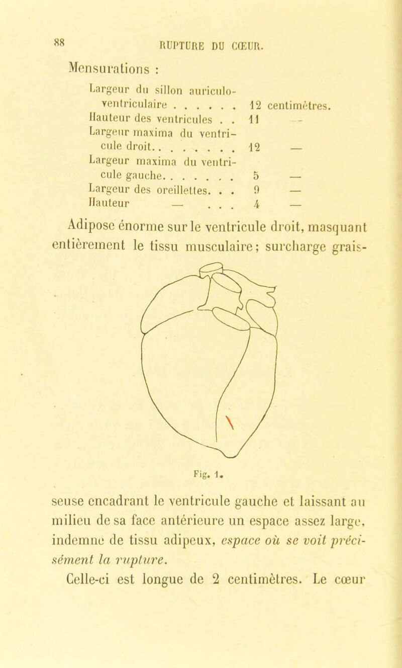 Mensurations : Largeur du sillon auricnlo- ventriculaire Hauteur des ventricules . . Largeur rnaxima du ventri- cule droit.. Largeur maxima du ventri- cule gauche Largeur des oreillettes. . . Hauteur — 12 centimètres. 11 12 — 5 D A Adipose énorme sur le ventricule droit, masquant entièrement le tissu musculaire; surcharge grais- seuse encadrant le ventricule gauche et laissant au milieu de sa face antérieure un espace assez large, indemne de tissu adipeux, espace où se voit préci- sément la rupture. Celle-ci est longue de 2 centimètres. Le cœur