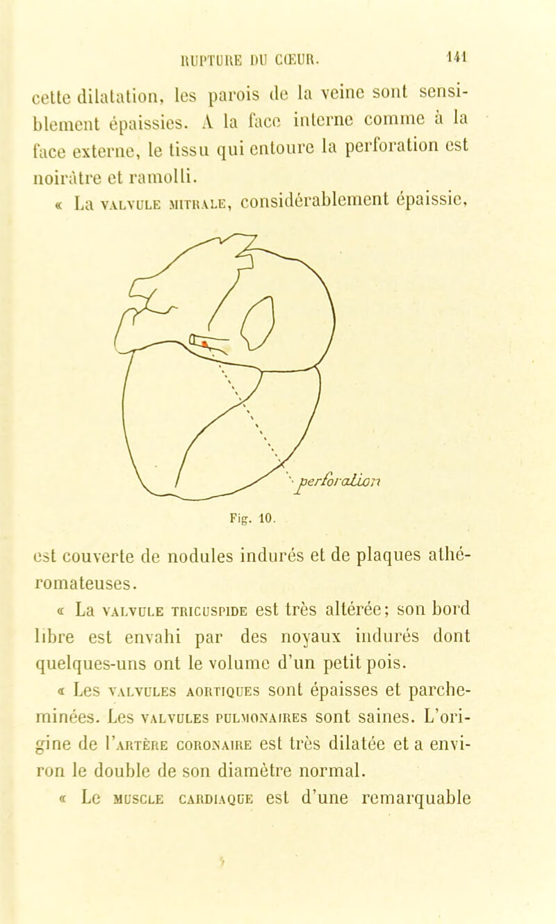 cette dilatation, les parois de la veine sont sensi- blement épaissies. A la face interne comme a la face externe, le tissu qui entoure la perforation est noirâtre et ramolli. « La valvule mitrale, considérablement épaissie, est couverte de nodules indurés et de plaques athé- romateuses. « La valvule tricuspide est très altérée; son bord libre est envahi par des noyaux indurés dont quelques-uns ont le volume d’un petit pois. « Les valvules aortiques sont épaisses et parche- minées. Les valvules pulmonaires sont saines. L’ori- gine de I’artère coronaire est très dilatée et a envi- ron le double de son diamètre normal. « Le muscle cardiaque est d’une remarquable