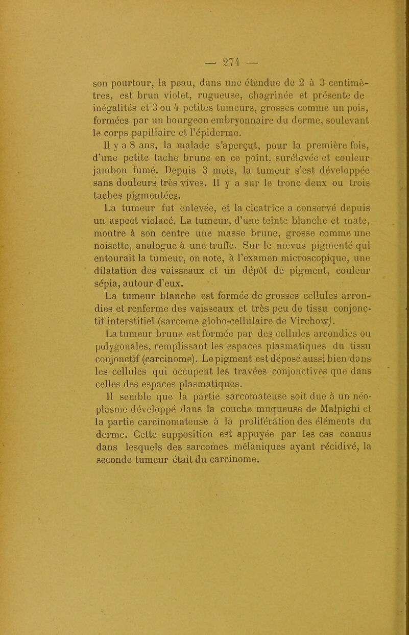 son pourtour, la peau, dans une étendue de 2 à 3 centimè- tres, est brun violet, rugueuse, chagrinée et présente de inégalités et 3 ou 4 petites tumeurs, grosses comme un pois, formées par un bourgeon embryonnaire du derme, soulevant le corps papillaire et l’épiderme. Il y a 8 ans, la malade s’aperçut, pour la première fois, d’une petite tache brune en ce point, surélevée et couleur jambon fumé. Depuis 3 mois, la tumeur s’est développée sans douleurs très vives. Il y a sur le tronc deux ou trois taches pigmentées. La tumeur fut enlevée, et la cicatrice a conservé depuis un aspect violacé. La tumeur, d’une teinte blanche et mate, montre à son centre une masse brune, grosse comme une noisette, analogue à une truffe. Sur le nœvus pigmenté qui entourait la tumeur, on note, à l’examen microscopique, une dilatation des vaisseaux et un dépôt de pigment, couleur sépia, autour d’eux. La tumeur blanche est formée de grosses cellules arron- dies et renferme des vaisseaux et très peu de tissu conjonc- tif interstitiel (sarcome globo-cellulaire de Virchow). La tumeur brune est formée par des cellules arrondies ou polygonales, remplissant les espaces plasmatiques du tissu conjonctif (carcinome). Le pigment est déposé aussi bien dans les cellules qui occupent les travées conjonctives que dans celles des espaces plasmatiques. Il semble que la partie sarcomateuse soit due à un néo- plasme développé dans la couche muqueuse de Malpighi et la partie carcinomateuse à la prolifération des éléments du derme. Cette supposition est appuyée par les cas connus dans lesquels des sarcomes mélaniques ayant récidivé, la seconde tumeur était du carcinome.