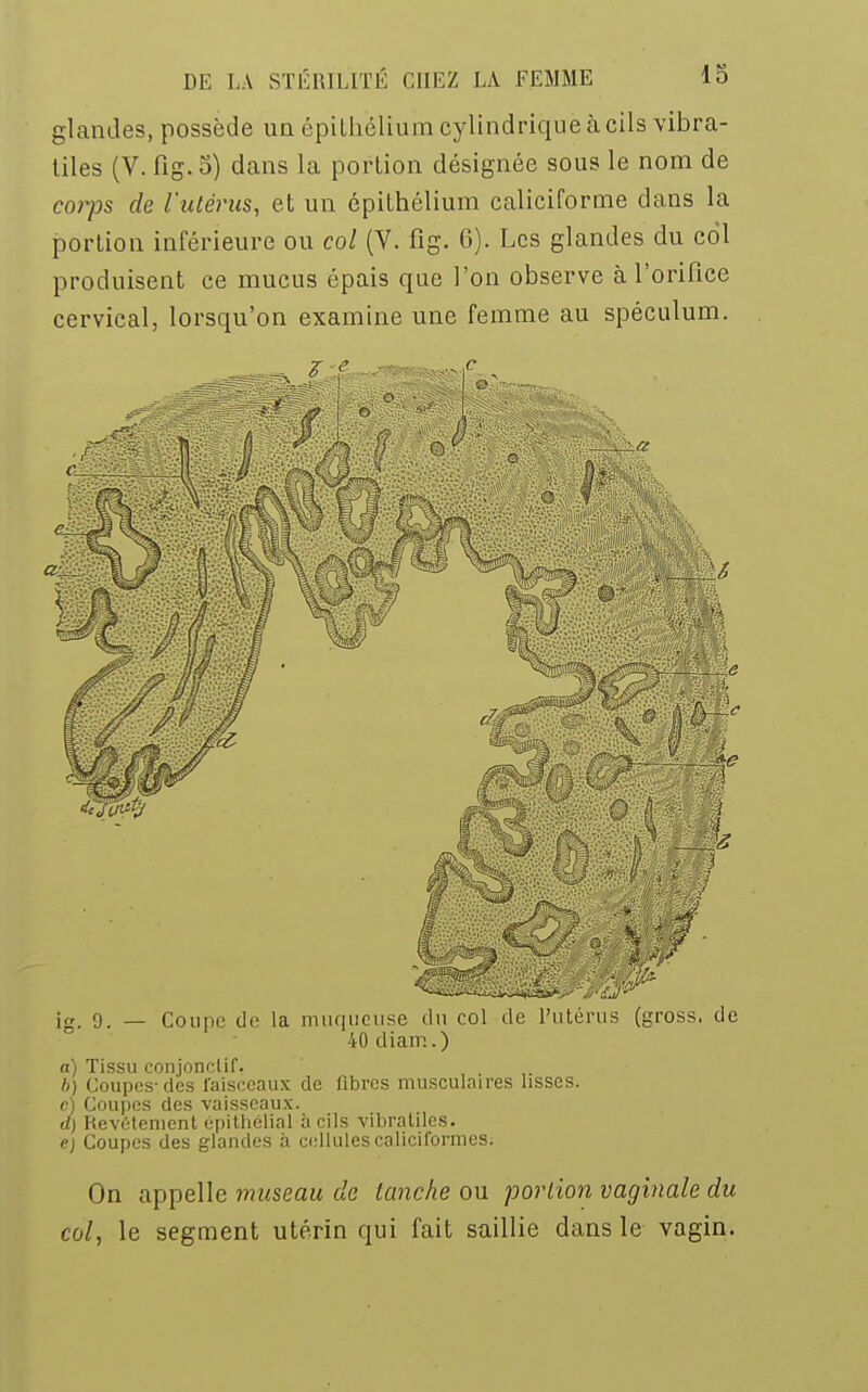 glandes, possède un épitliélium cylindrique à cils vibra- tiles (V. fig. 5) dans la portion désignée sous le nom de coiys de l'utérus, et un épithélium caliciforme dans la portion inférieure ou col (V. fig. 6). Les glandes du col produisent ce mucus épais que l'on observe à l'orifice cervical, lorsqu'on examine une femme au spéculum. ig, g. _ Coupe de la muqueuse du col de l'utérus (gross. de 40 diam.) a) Tissu conjonelif. b) Coupes-des faisceaux de fibres musculaires lisses. c) Coupes des vaisseaux. d) Revêtement épithélial à cils vibratileS. <?; Coupes des glandes à cellules caliciformes. On appelle museau de tanche ou portion vaginale du col, le segment utérin qui fait saillie dans le vagin.