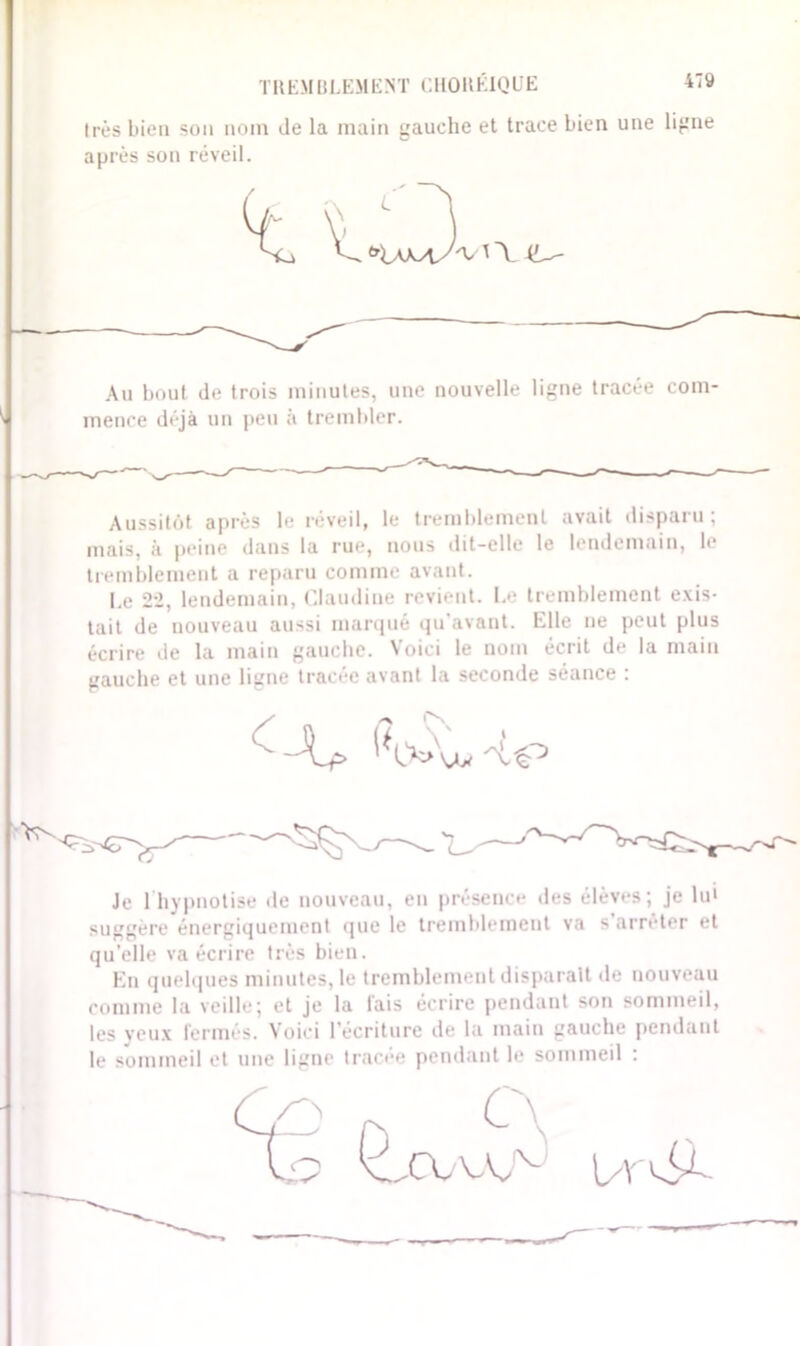 TREMBLEMENT CHORÉIQUE très bien son nom de la main gauche et trace bien une ligne après son réveil. Au bout de trois minutes, une nouvelle ligne tracée com- mence déjà un peu à trembler. Aussitôt après le réveil, le tremblement avait disparu; mais, à peine dans la rue, nous dit-elle le lendemain, le tremblement a reparu comme avant. Le 22, lendemain, Claudine revient. Le tremblement exis- tait de nouveau aussi marqué qu’avant. Elle ne peut plus écrire de la main gauche. Voici le nom écrit de la main gauche et une ligne tracée avant la seconde séance : Je 1 hypnotise de nouveau, en présence des élèves; je lu» suggère énergiquement que le tremblement va s arrêter et qu'elle va écrire très bien. En quelques minutes, le tremblement disparaît de nouveau comme la veille; et je la lais écrire pendant son sommeil, les veux fermés. Voici l’écriture de la main gauche pendant le sommeil et une ligne tracée pendant le sommeil :