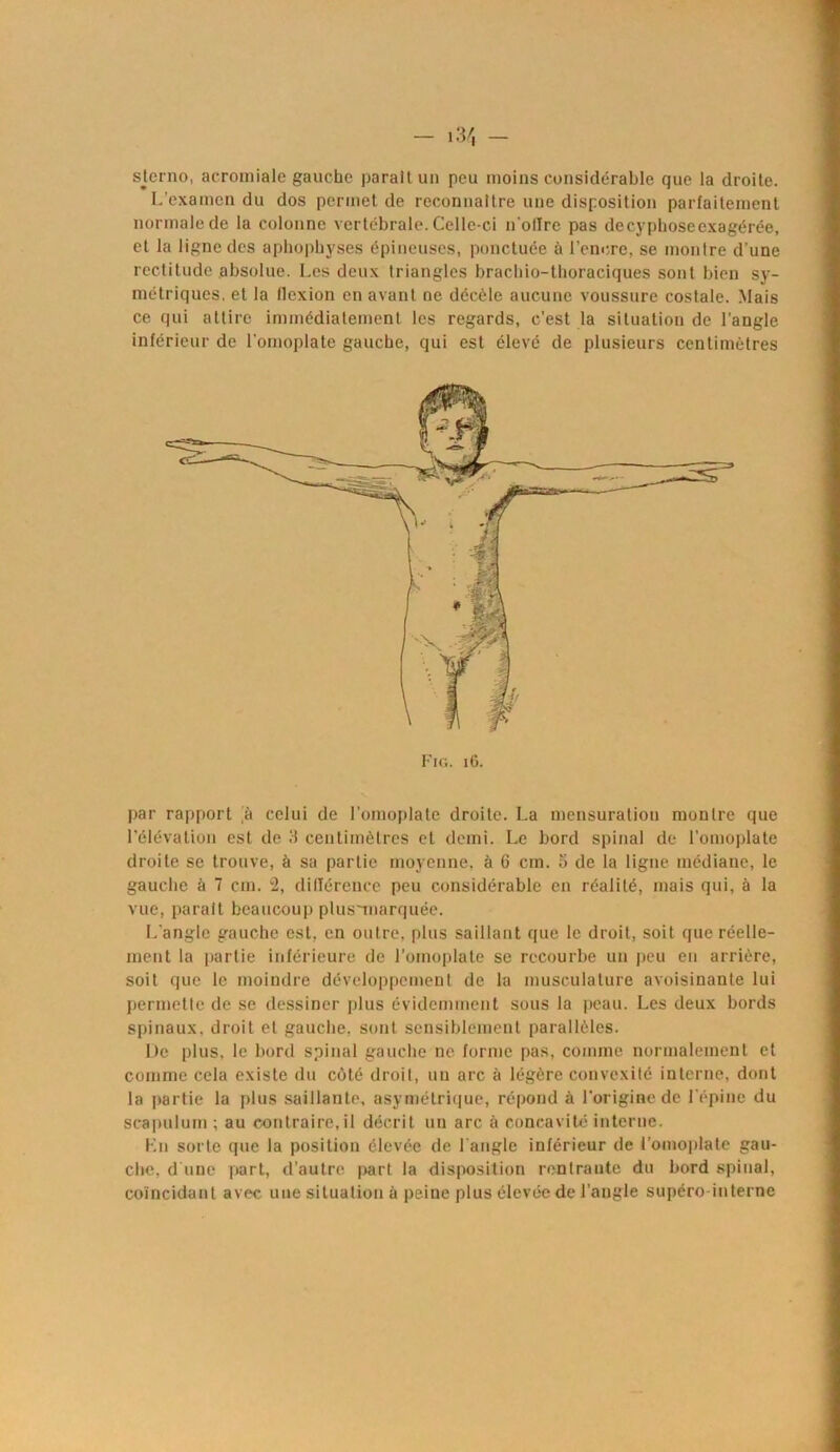 sterno, acromiale gauche parait un peu moins considérable que la droite. L’examen du dos permet de reconnaître une disposition parfaitement normale de la colonne vertébrale. Celle-ci notice pas decyphosecxagérée, et la ligne des aphopbyses épineuses, ponctuée à l'encre, se montre d’une rectitude absolue. Les deux triangles bracbio-tboraciques sont bien sy- métriques. et la flexion en avant ne décèle aucune voussure costale. Mais ce qui attire immédiatement les regards, c’est la situation de l’angle inférieur de l’omoplate gaucbe, qui est élevé de plusieurs centimètres Fig. iG. par rapport a celui de l’omoplate droite. La mensuration montre que l’élévation est de 3 centimètres et demi. Le bord spinal de l'omoplate droite se trouve, à sa partie moyenne, à 6 cm. 5 de la ligne médiane, le gauche à 7 cm. 2, différence peu considérable en réalité, mais qui, à la vue, parait beaucoup plus-marquée. L’angle gauche est, en outre, plus saillant que le droit, soit que réelle- ment la partie inférieure de l'omoplate se recourbe un peu en arrière, soit que le moindre développement de la musculature avoisinante lui permette de se dessiner plus évidemment sous la peau. Les deux bords spinaux, droit et gauche, sont sensiblement parallèles. De plus, le bord spinal gauche ne forme pas, comme normalement et comme cela existe du côté droit, un arc à légère convexité interne, dont la partie la plus saillante, asymétrique, répond à l'origine de l’épine du scapulum ; au contraire, il décrit un arc à concavité interne. Kn sorte que la position élevée de l'angle inférieur de l’omoplate gau- che, d une part, d’autre part la disposition rentrante du bord spinal, coïncidant avec une situation à peine plus élevée de l’angle supéro-interne