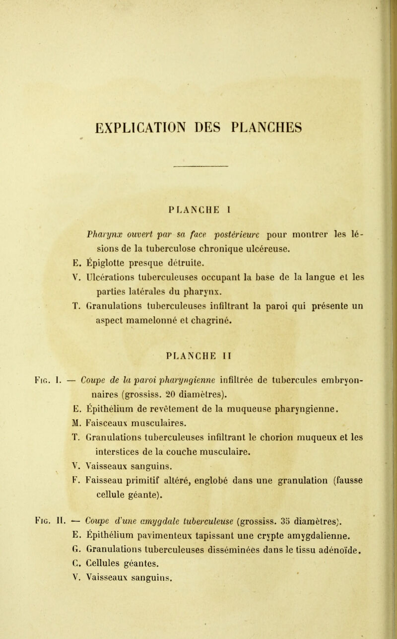 EXPLICATION DES PLANCHES PLANCHE 1 Phanjnx ouvert par sa face postérieure pour montrer les lé- sions de la tuberculose chronique ulcéreuse. E. Épiglotte presque détruite. V. Ulcérations tuberculeuses occupant la base de la langue et les parties latérales du pharynx. T. Granulations tuberculeuses infiltrant la paroi qui présente un aspect mamelonné et chagriné. PLANCHE II FiG. 1. — Coupe de la paroi pharyngienne infiltrée de tubercules embryon- naires (grossiss. 20 diamètres). E. Épithélium de revêtement de la muqueuse pharyngienne. M. Faisceaux musculaires. T. Granulations tuberculeuses infiltrant le chorion muqueux et les interstices de la couche musculaire. V. Vaisseaux sanguins. F. Faisseau primitif altéré, englobé dans une granulation (fausse cellule géante). FiG. 11. — Coupe tVune amygdale tuberculeuse (grossiss. 35 diamètres). E. Épithélium pavimenteux tapissant une crypte amygdalienne. G. Granulations tuberculeuses disséminées dans le tissu adénoïde. C. Cellules géantes. V. Vaisseaux sanguins.