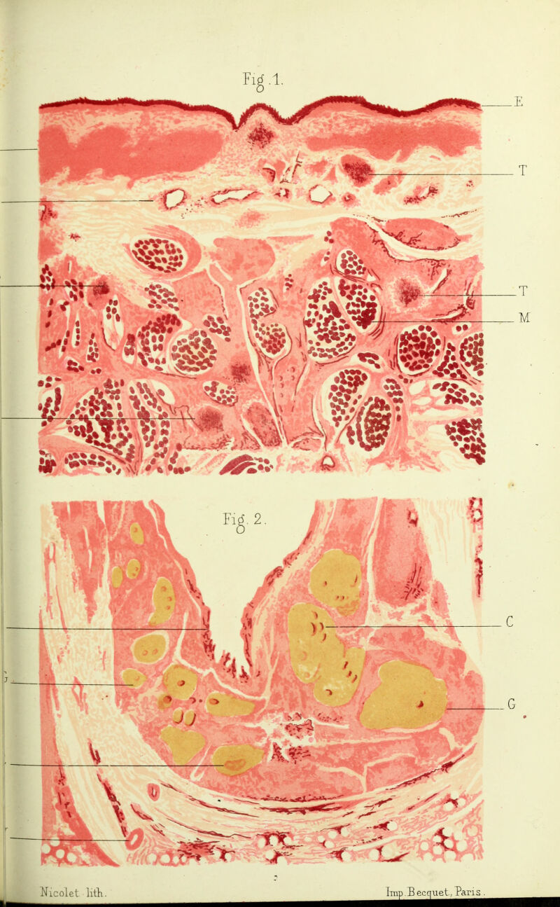 Nicolet litli Tinp .E ecquet; Pans