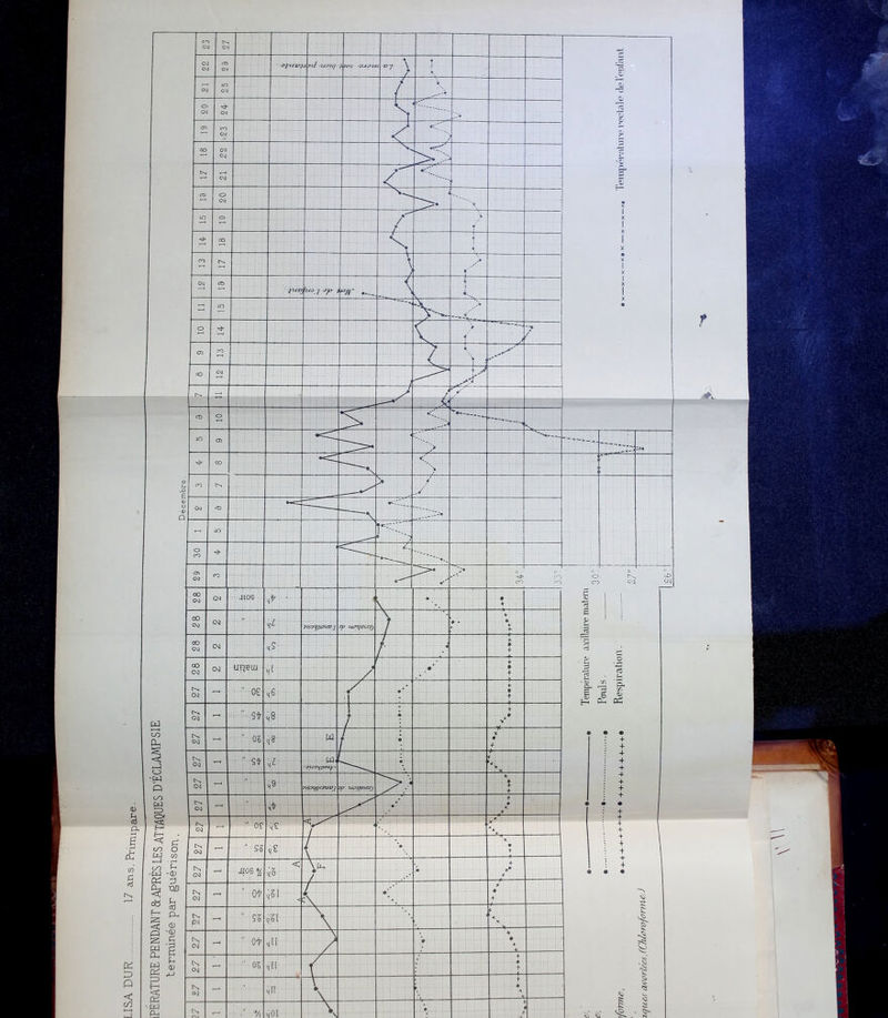LISA DUR 17 ans. Primipare. IPERATURE PENDANT &APRÈS LES ATTAQUES D’ÉCLAMPSIE terminée par guérison,