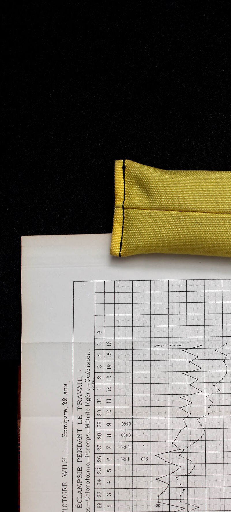 No text description is available for this image