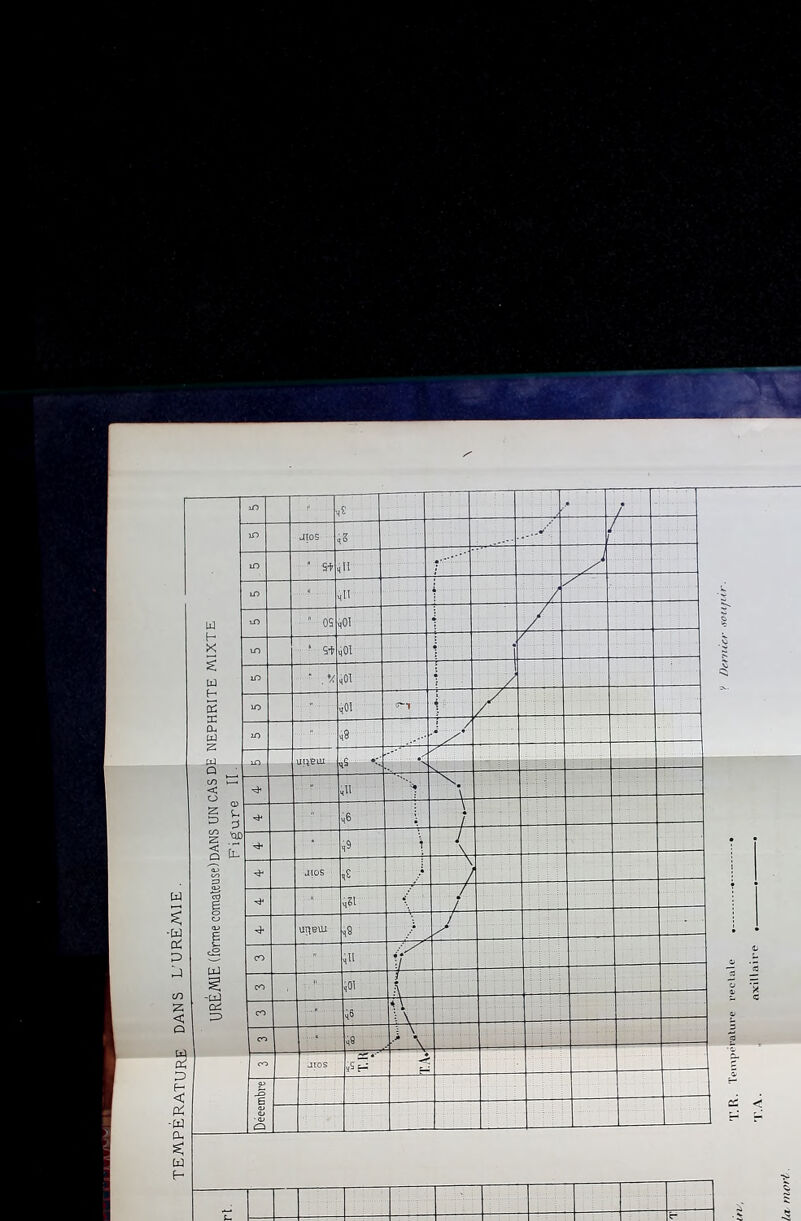 PÉRATURE DANS L'URÉAVIE . UREWE (forme comateuse)DANS UN CAS DE NEPHRITE MIXTE Figure IL iT) l s l iD JlOS J / lO ’ Sf (Il lO ,11 iT) ' 09 ,01 i m ■ ' W ^01 : iD ■ .*/ î } lO  # i lO q8 ! / iT) unetu. i K < ^ - - ’ïJ* ,11 , \ f . ,6 i . / • q9 \ y \ •aios qS i I ■ ,51 ( u^eui q9 ) ■ - ■ CO  ill CO . !' 401 K H ri CO ■> 46 -vr~ ) \ i H CO ■ ■ 49 'Ta = i IJ CO jros Déeembre — 'r. R. l'eclale