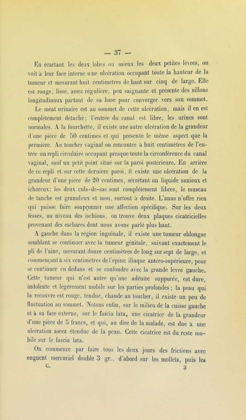 En écartant les deux lobes ou mieux les deux petites lèvres, on voit à leur face interne une ulcération occupant toute la hauteur de la tumeur et mesurant huit centimètres de haut sur cinq de large. Elle est rouge, lisse, assez régulière, peu saignante et présente des sillons longitudinaux partant de sa base pour converger vers son sommet. Le méat urinaire est au sommet de cette ulcération, mais il en est complètement détaché: l'entrée du canal est libre, les urines sont normales. A la fourchette, il existe une autre ulcération de la grandeur d'une pièce de 50 centimes et qui présente le même aspect que la première. Au toucher vaginal on rencontre à huit centimètres de l'en- trée un repli circulaire occupant presque toute la circonférence du canal vaginal, sauf un petit point situé sur la paroi postérieure. En arrière de ce repli et sur cette dernière paroi, il existe une ulcération de la grandeur d'une pièce de 20 centimes, sécrétant un liquide sanieux et ichoreux: les deux culs-de-sac sont complètement libres, le museau de tanche est granuleux et mou, surtout à droite. L'anus n'offre rien qui puisse faire soupçonner une affection spécifique. Sur les deux fesses, au niveau des ischions, on trouve deux plaques cicatricielles provenant des eschares dont nous avons parlé plus haut. A gauche dans la région inguinale, il existe une tumeur oblongue semblant se continuer avec la tumeur génitale, suivant exactement le pli de l'aine, mesurant douze centimètres de long sur sept de large, et commençant à six centimètres de l'épine iliaque anléro-supérieure, pour se continuer en dedans et se confondre avec la grande lèvre gauche. Celte tumeur qui n'est autre qu'une adénite suppurée, est dure, indolente et légèrement mobile sur les parties profondes ; la peau qui la recouvre est rouge, tendue, chaude au toucher, il existe un peu de fluctuation au sommet. Notons enfin, sur le milieu de la cuisse gauche et à sa face externe, sur le fascia lata, une cicatrice de la grandeur d'une pièce de 5 francs, et qui, au dire de la malade, est due à une ulcération aseez étendue de la peau. Celte cicatrice est du reste mo- bile sur le fascia lata. On commence par faire tous les deux jours des frictions avec onguent mercuriel double 3 gr., d'abord sur les mollets, puis les G. c>